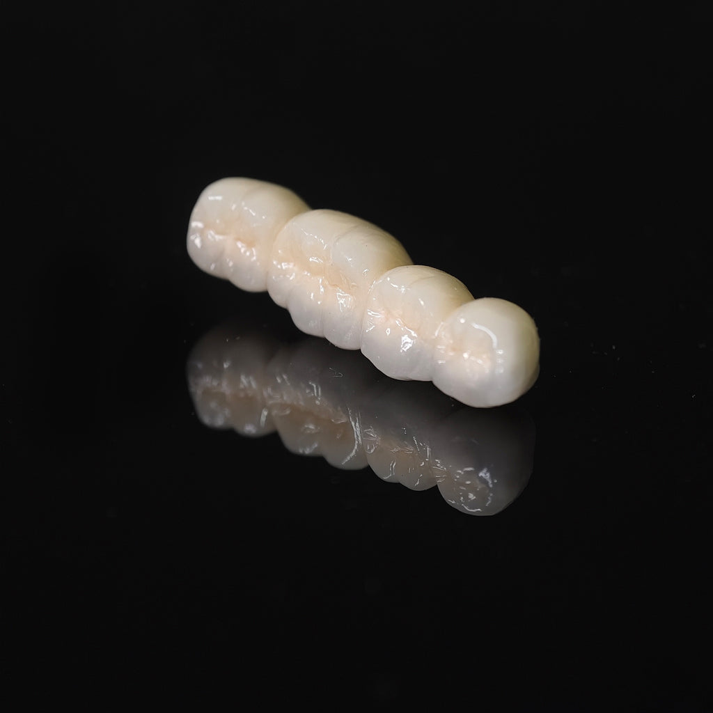 Co - Cr PFM Dental Bridge