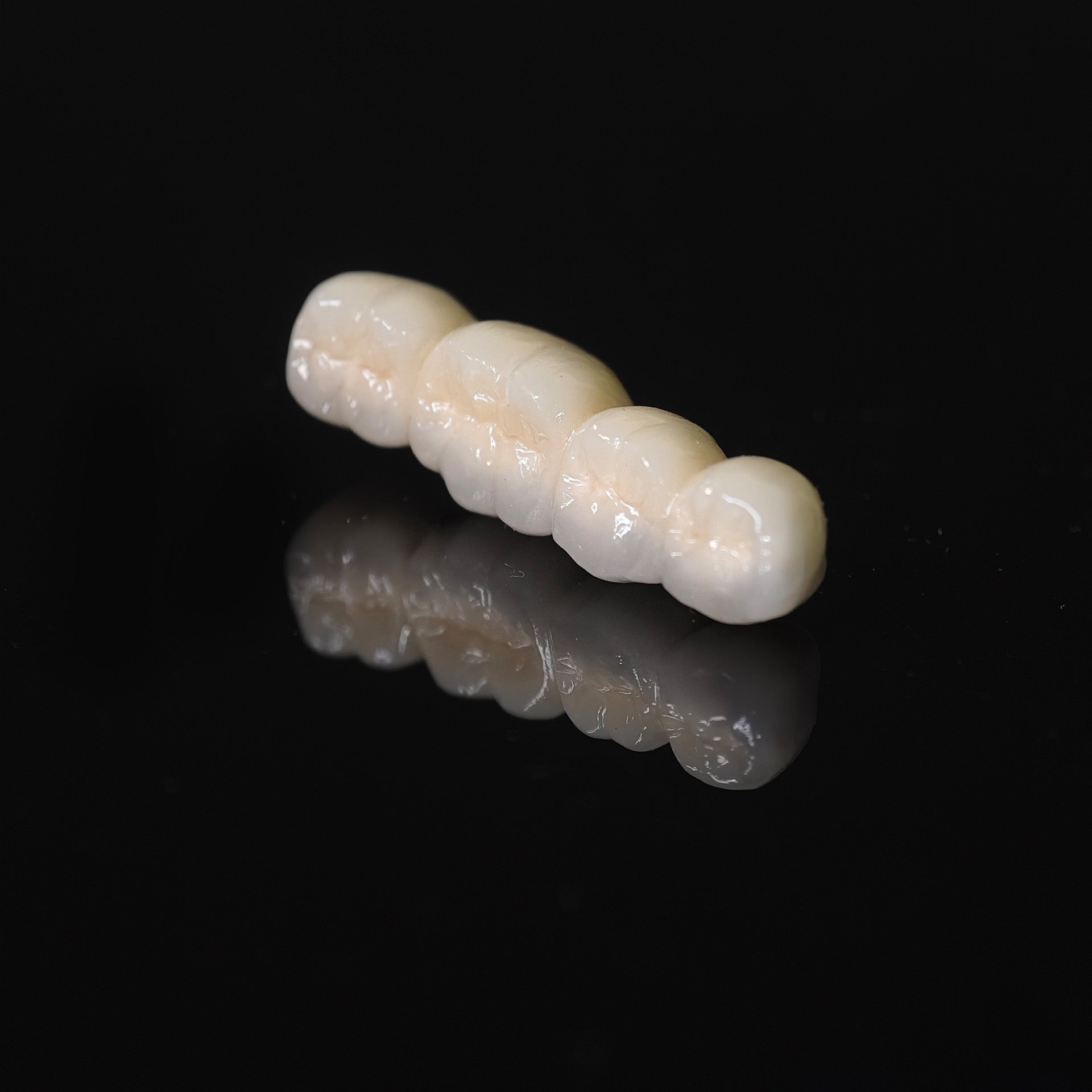 Co - Cr PFM Dental Bridge
