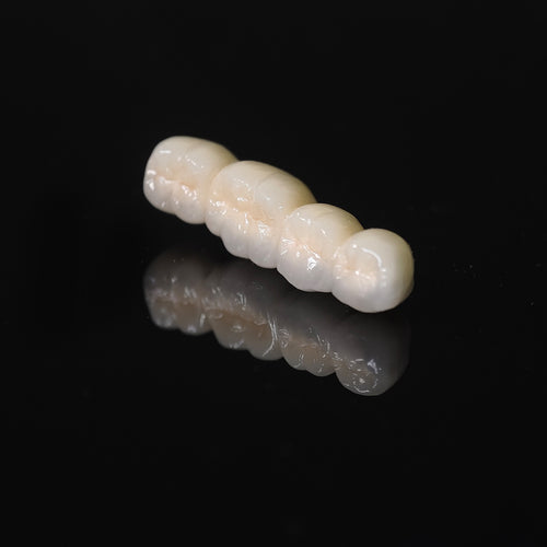 Co - Cr PFM Dental Bridge