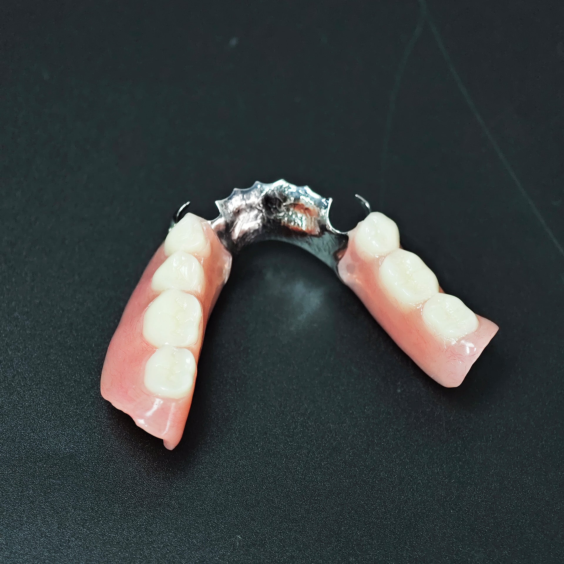 Cobalt Chrome Framework Denture Metal Framework With Acrylic Denture