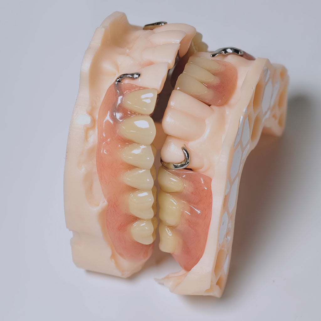 Cobalt Chrome Framework Denture Metal Framework With Acrylic Denture