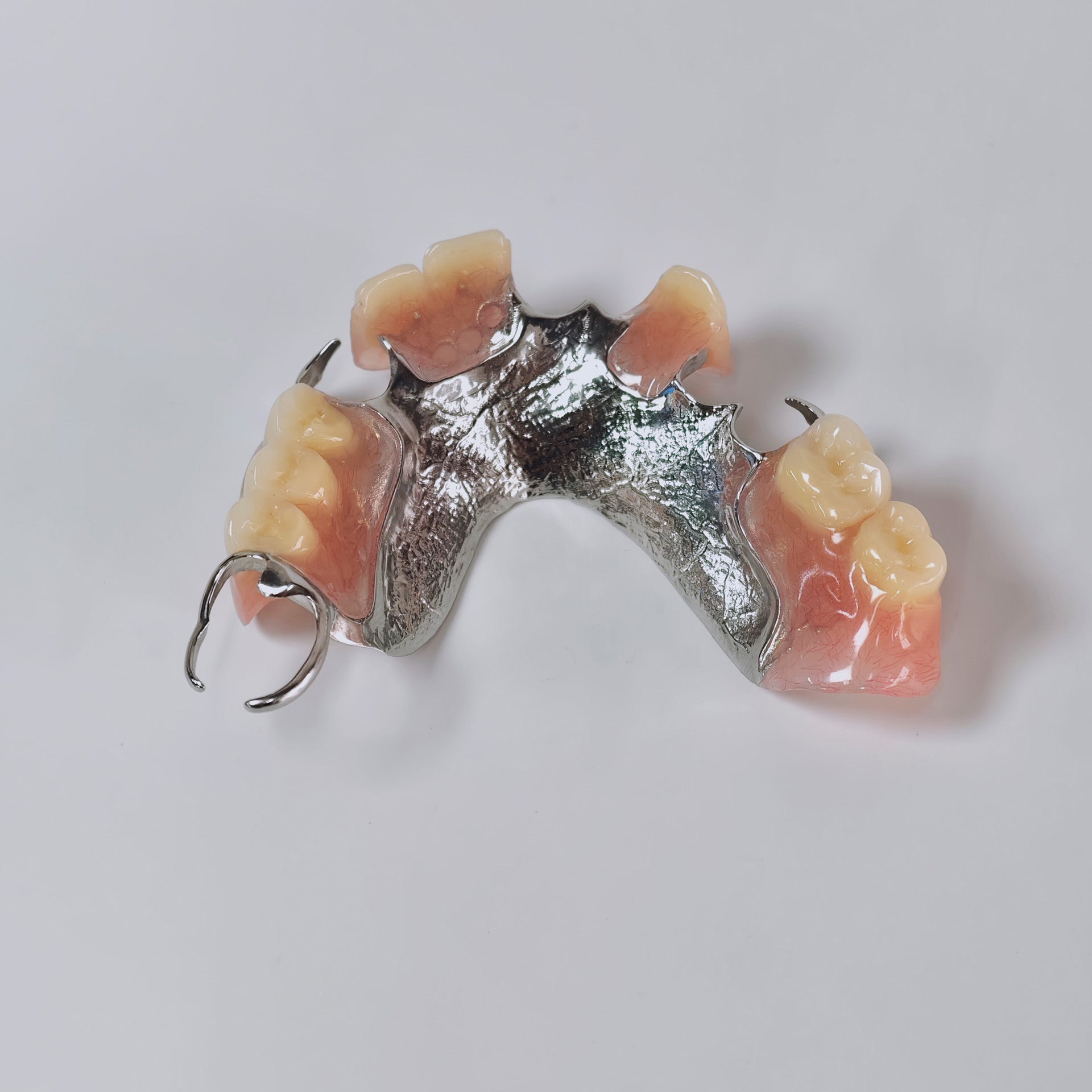 Cobalt Chrome Framework Denture Metal Framework With Acrylic Denture