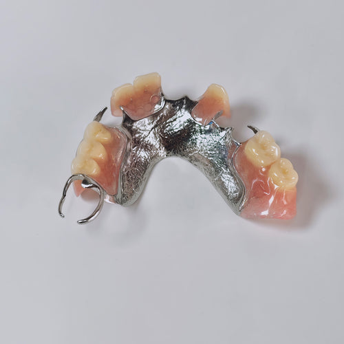 Cobalt Chrome Framework Denture Metal Framework With Acrylic Denture