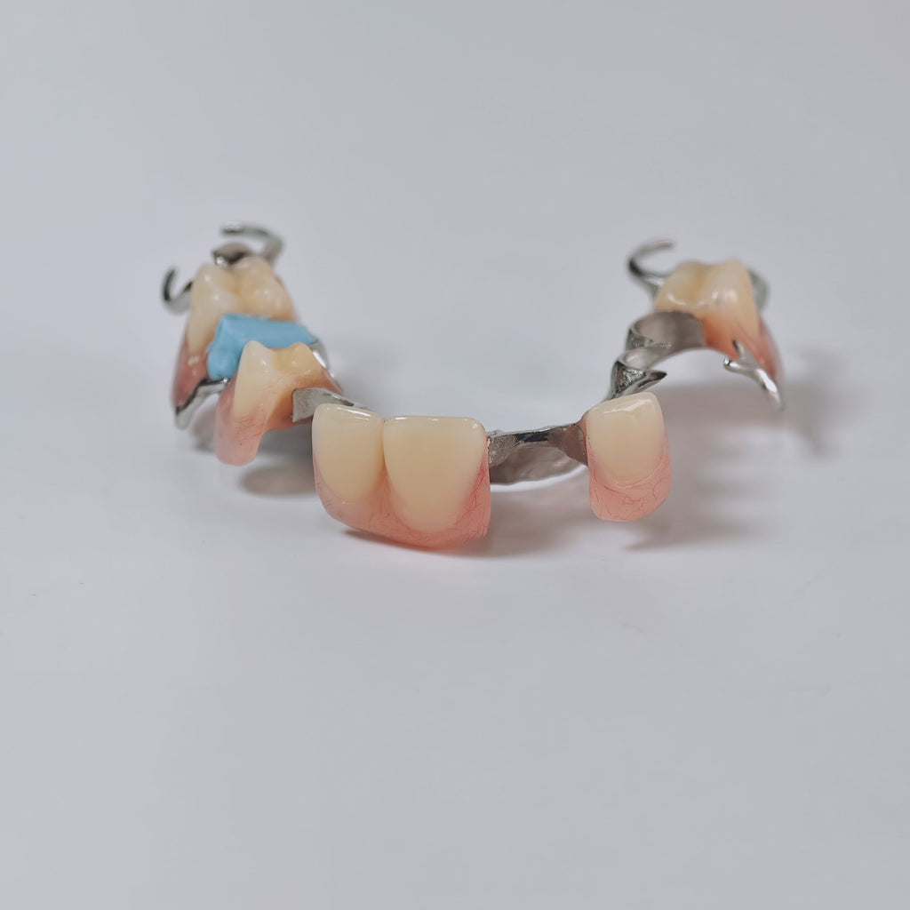 Cobalt Chrome Framework Denture Metal Framework With Acrylic Denture