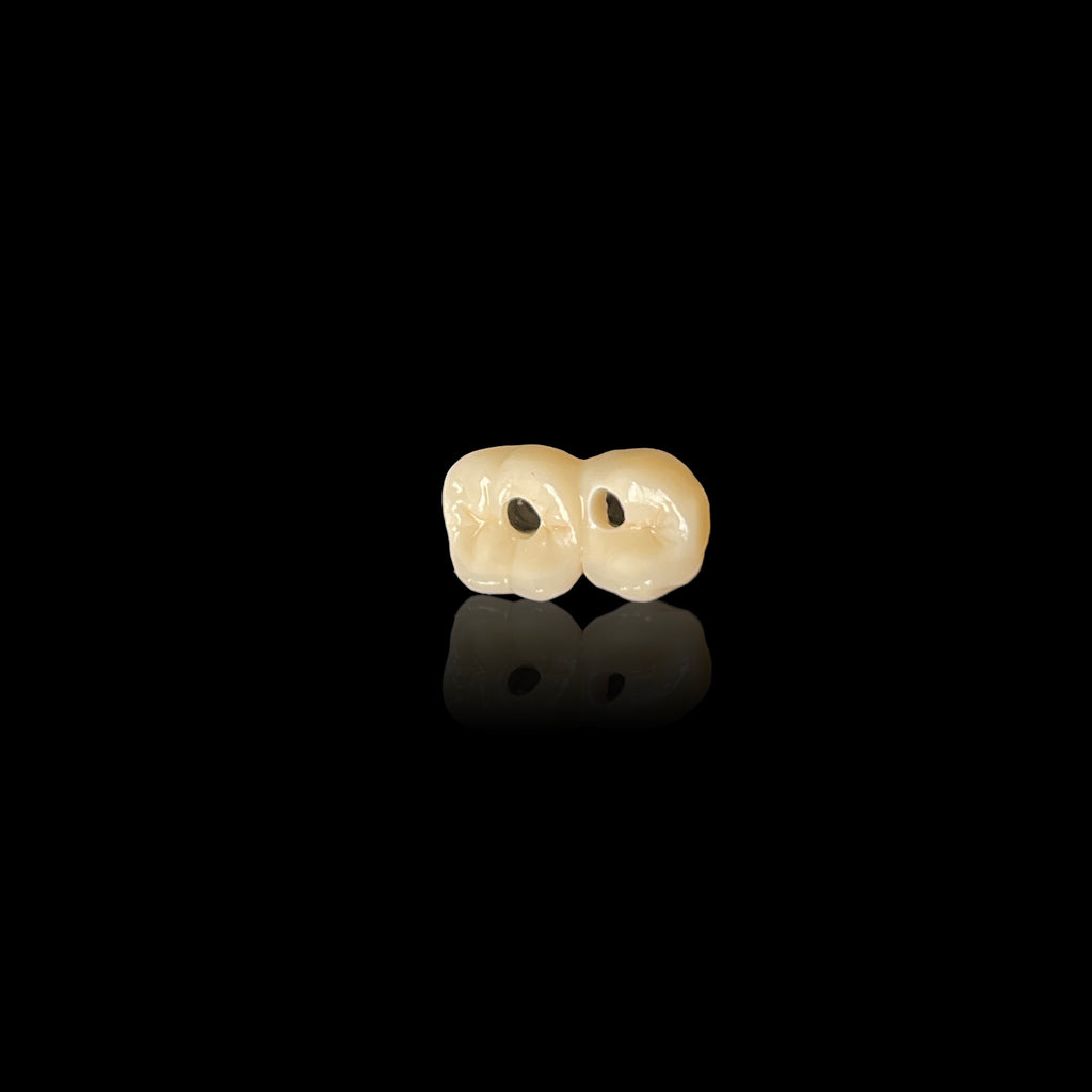 Custom Zirconia Implant Bridge