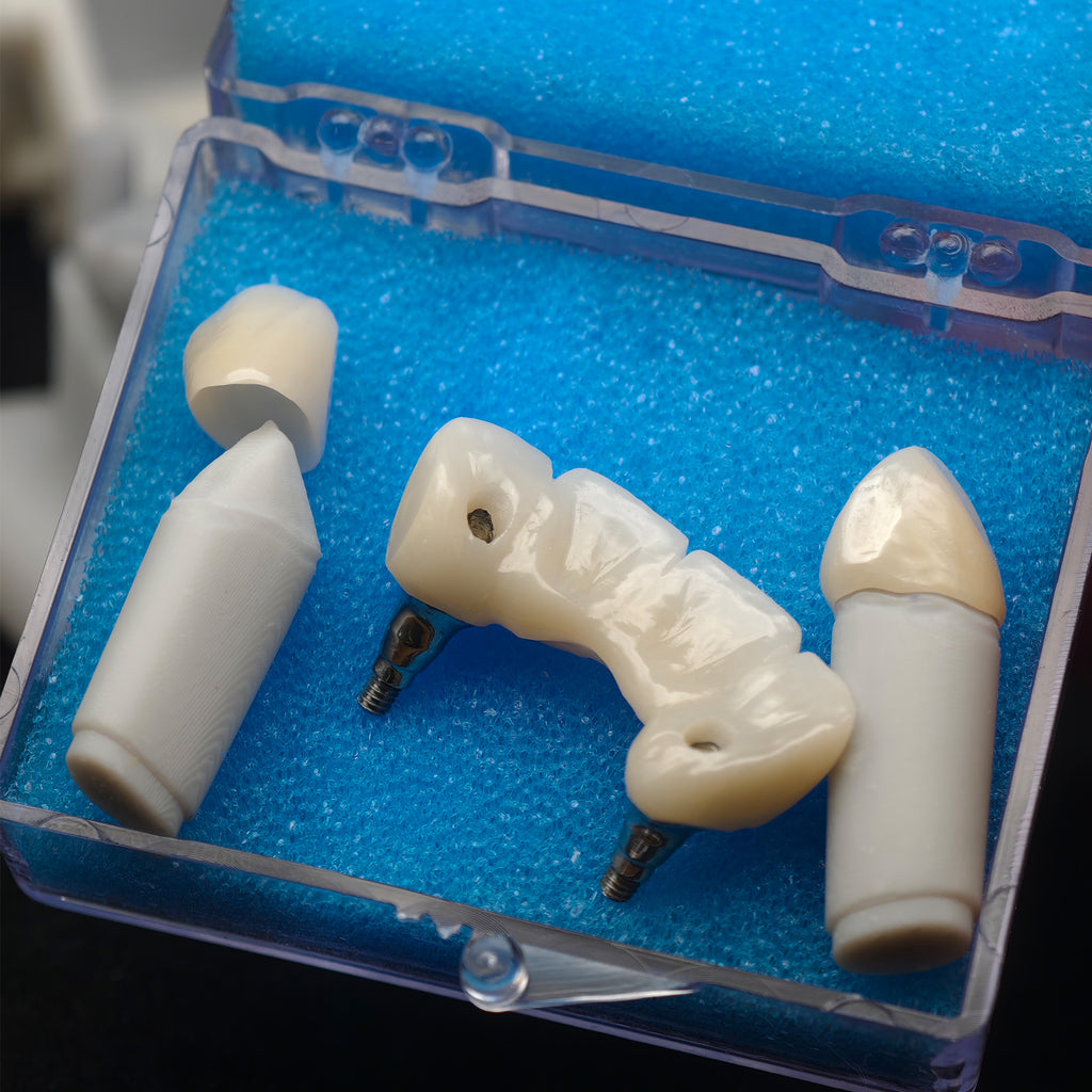 Custom Zirconia Implant Bridge
