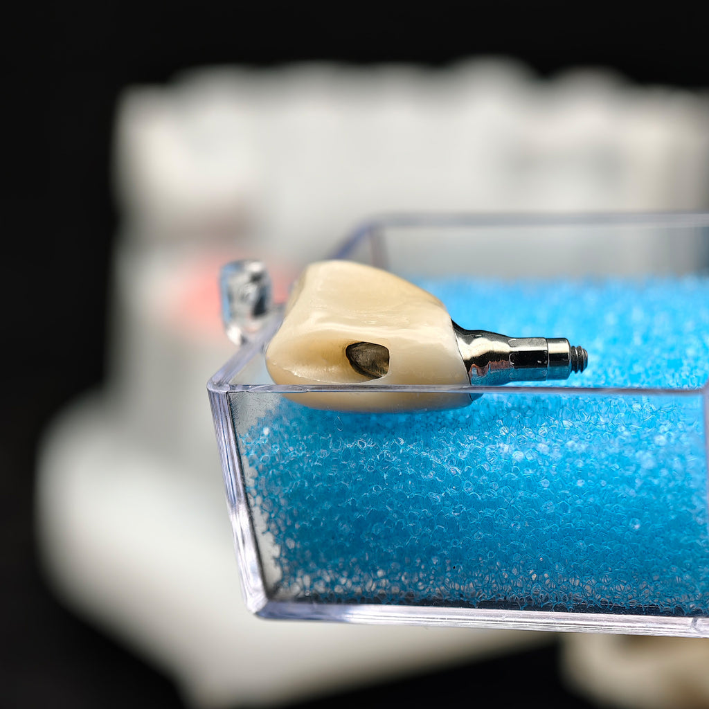 Custom Zirconia Implant Crown