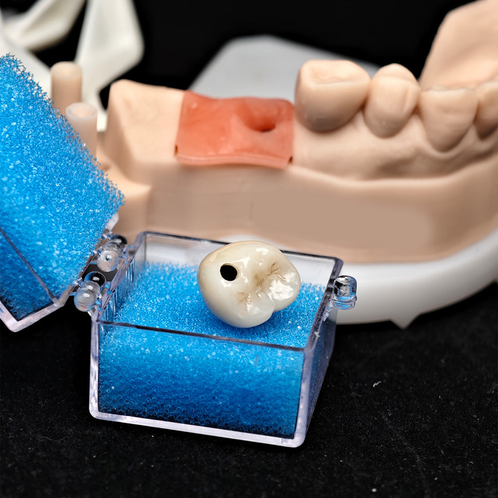 Custom Zirconia Implant Crown