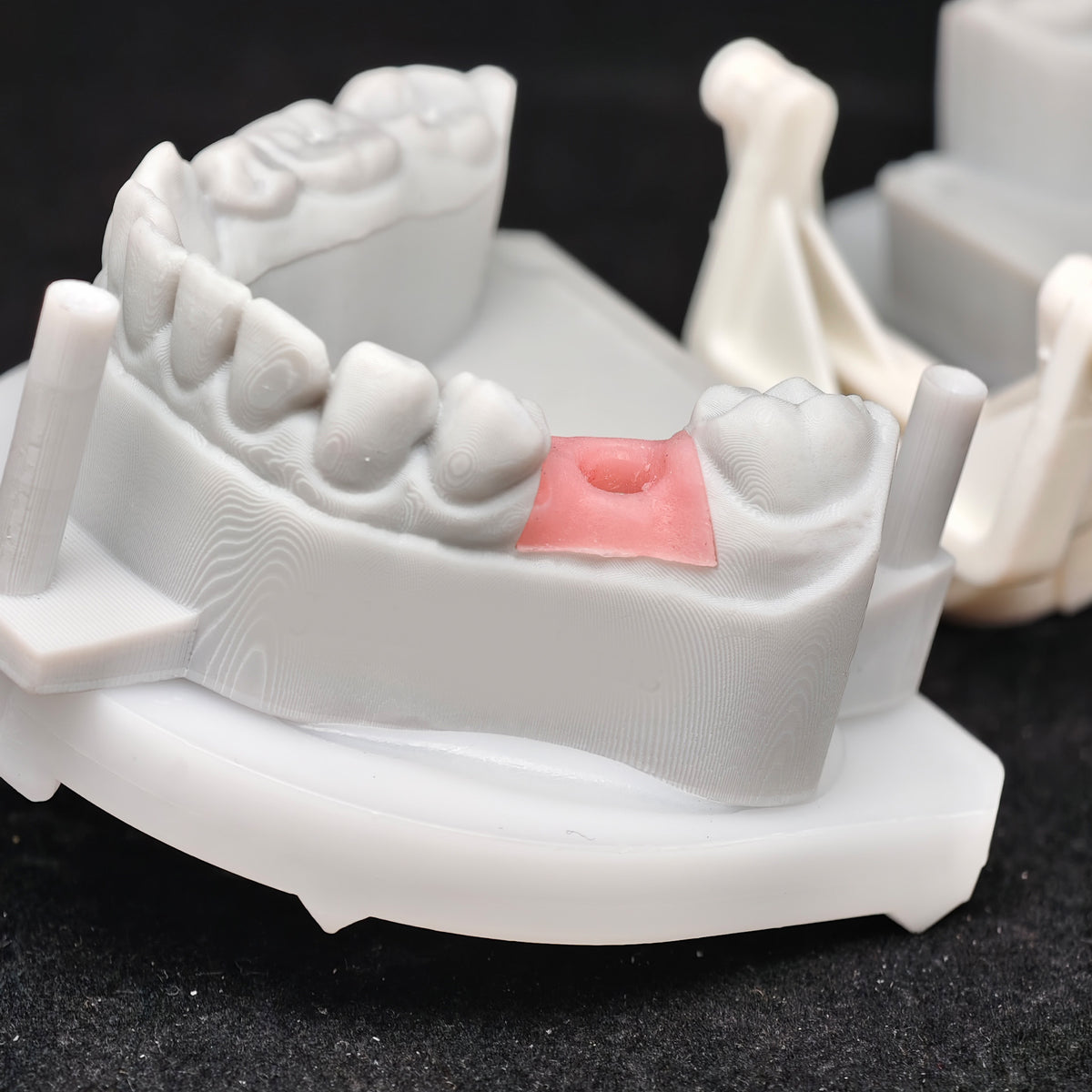 Custom Zirconia Implant Crowns