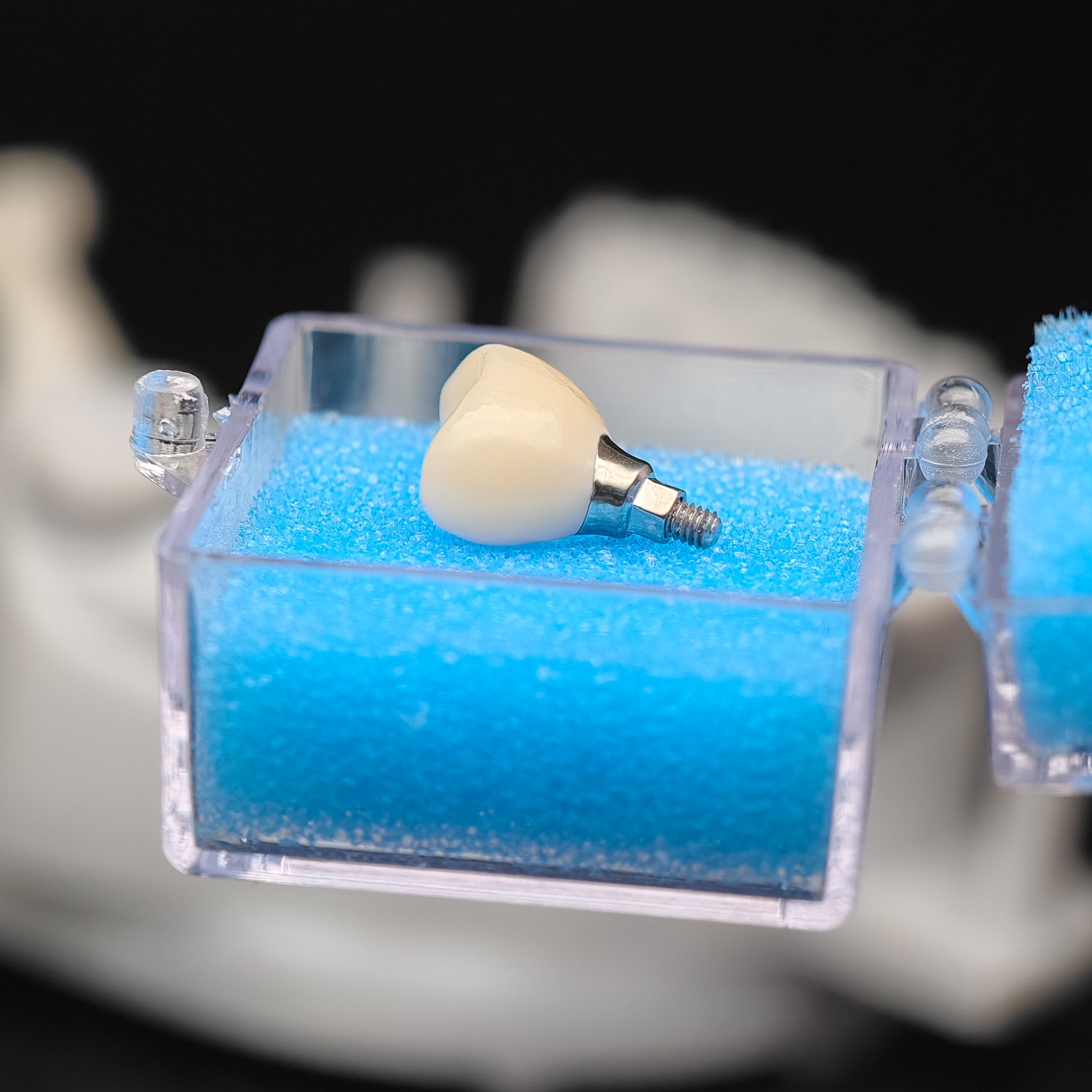 Custom Zirconia Implant Crowns