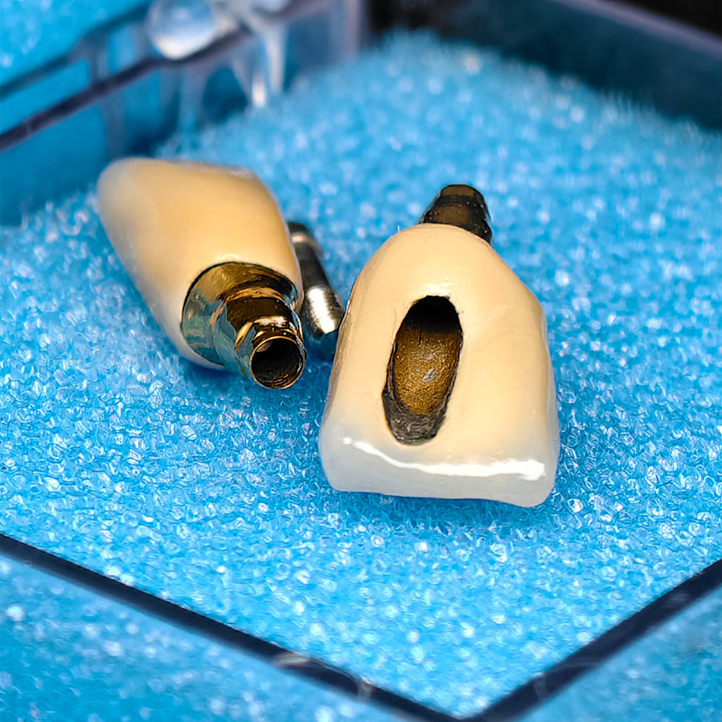 Custom Zirconia Implant Crowns