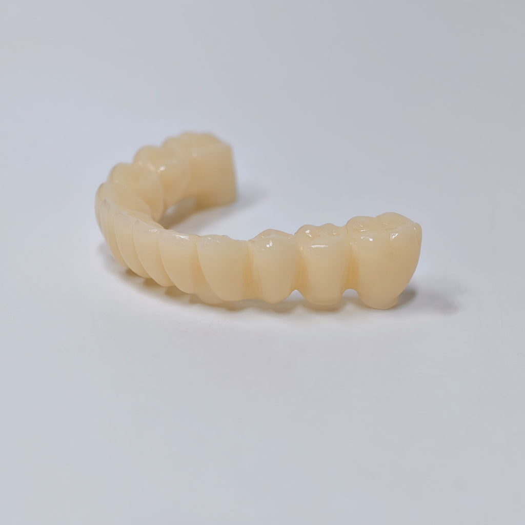 Custom Abutment And PMMA Bridge With Cement Retained And Implant Seating Guide