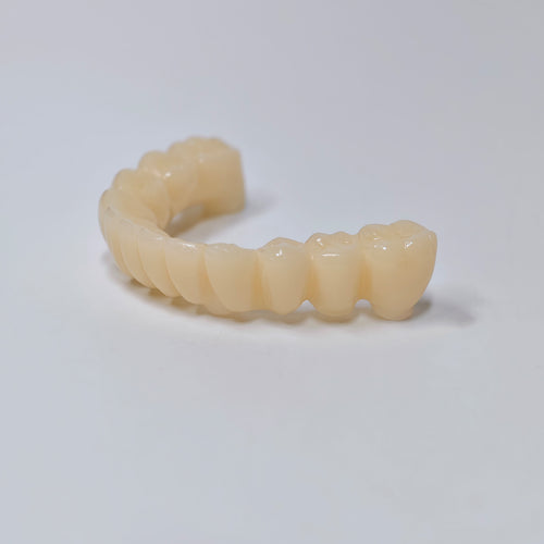 Custom Abutment And PMMA Bridge With Cement Retained And Implant Seating Guide