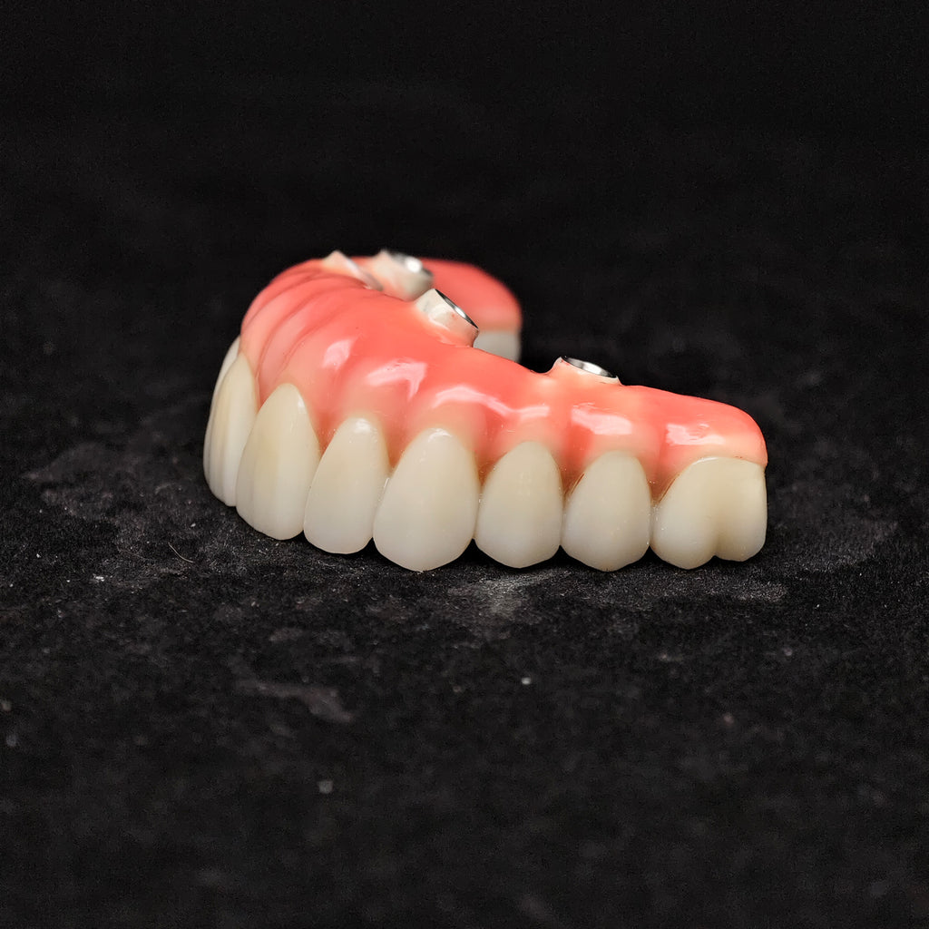 Enhanced Zirconia Crown Malo Bridge
