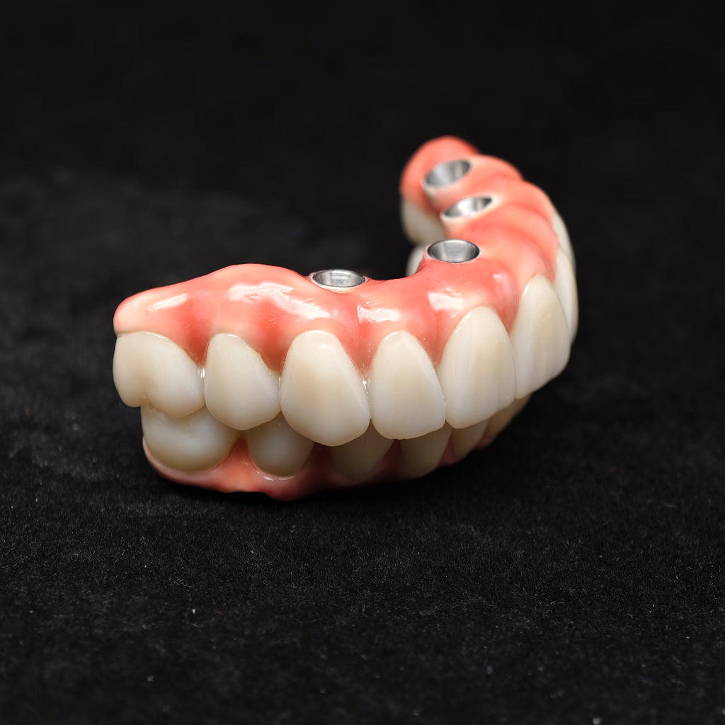 Enhanced Zirconia Crown Malo Bridge