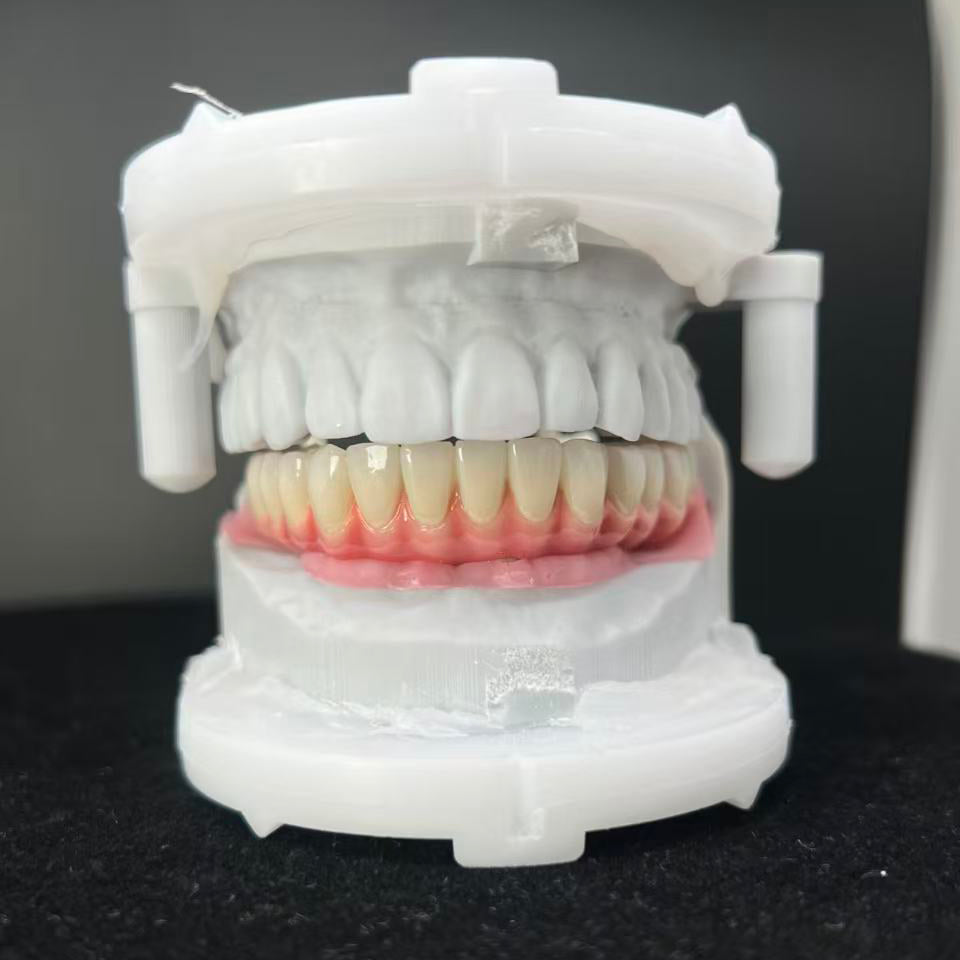 Enhanced Zirconia Crown Malo Bridge