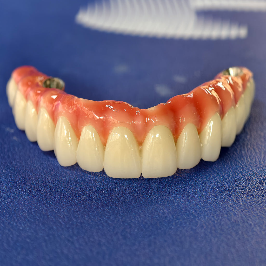Enhanced Zirconia Crown Malo Bridge