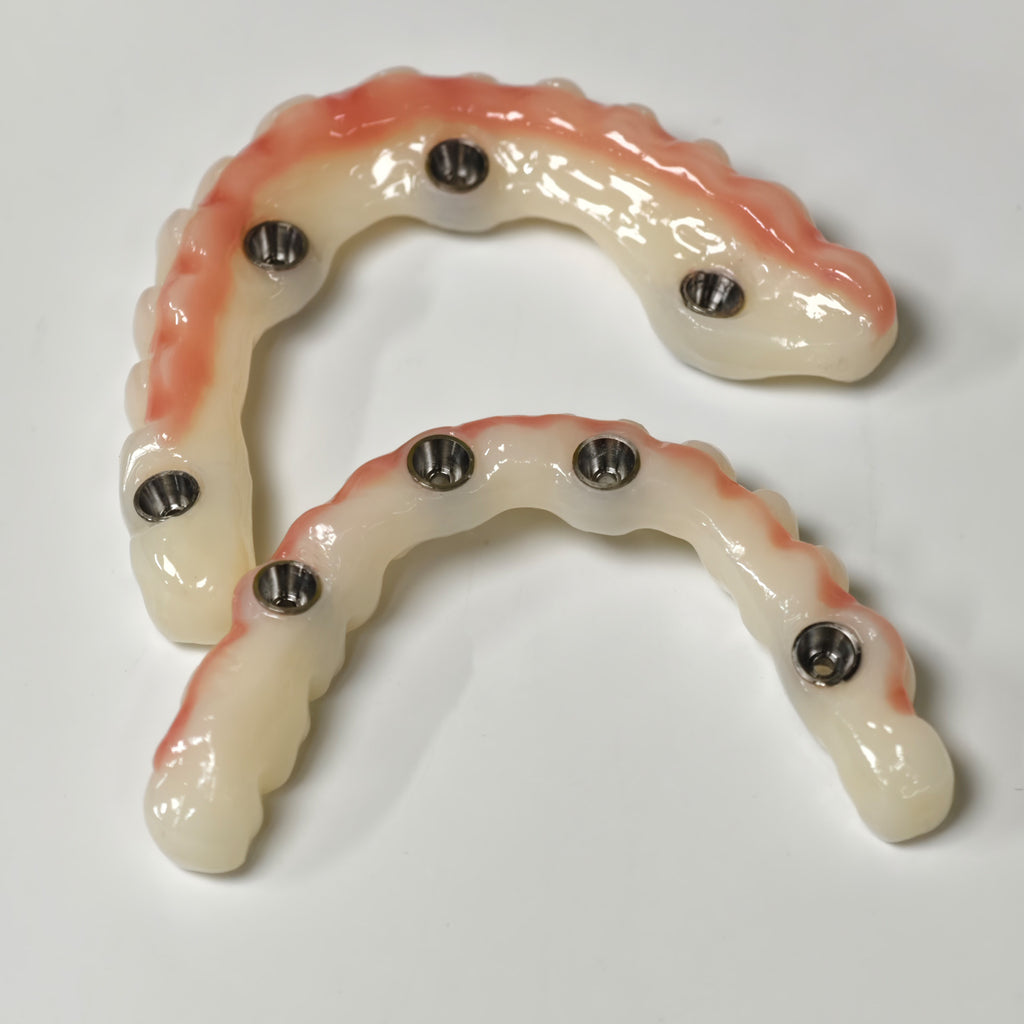 Full-Arch PMMA Bridge With Ti-Base Screw Retained
