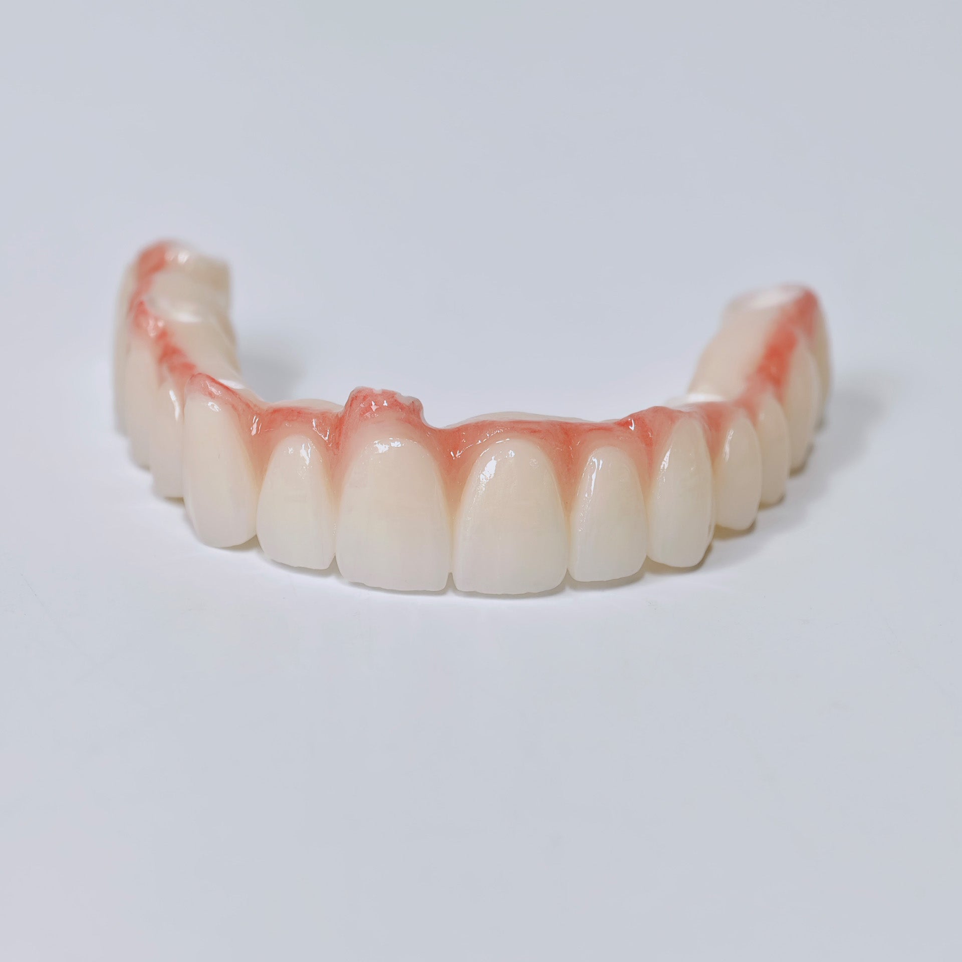 Half-Mouth Zirconia Bridge With Cement-Retained
