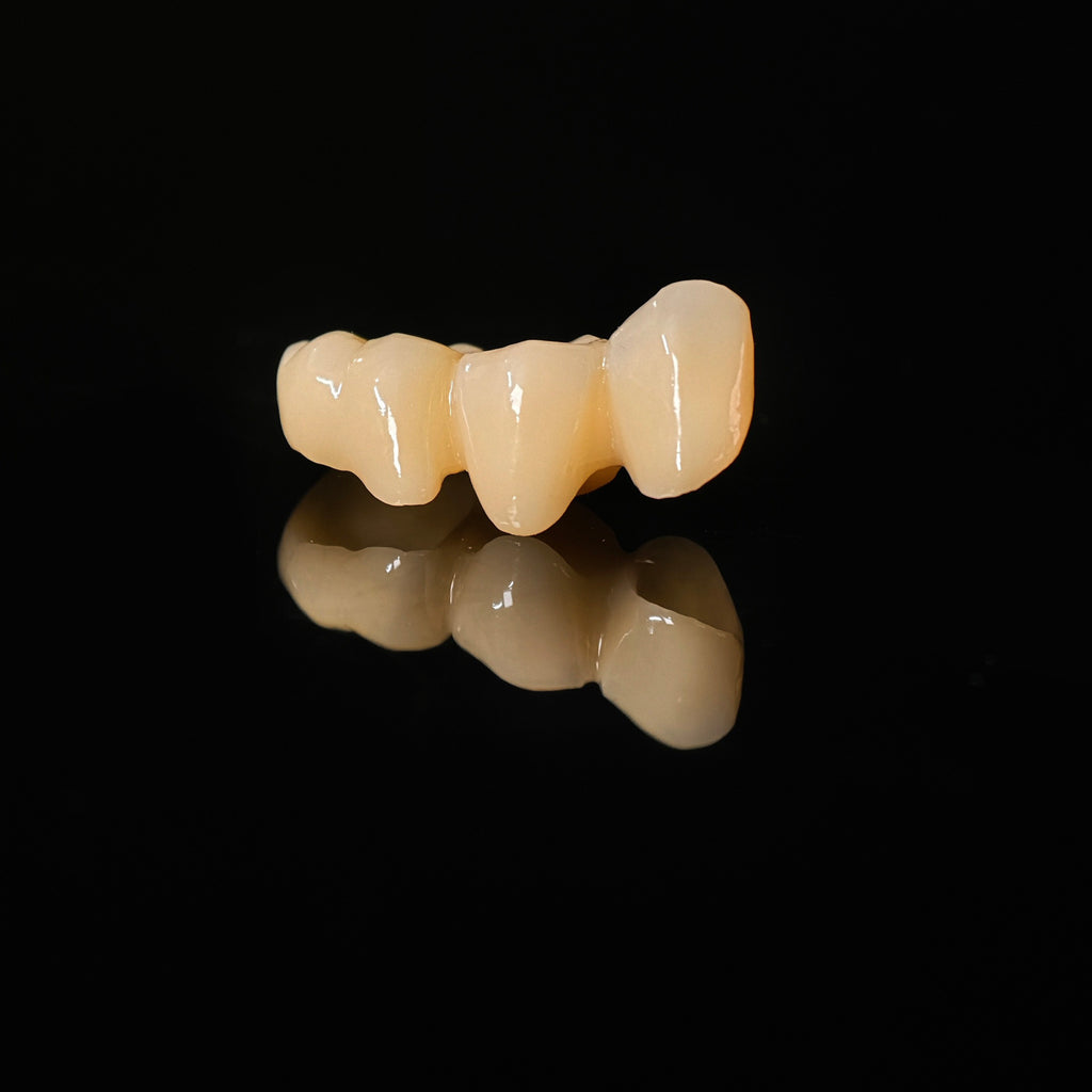 High - Strength Zirconia Bridge