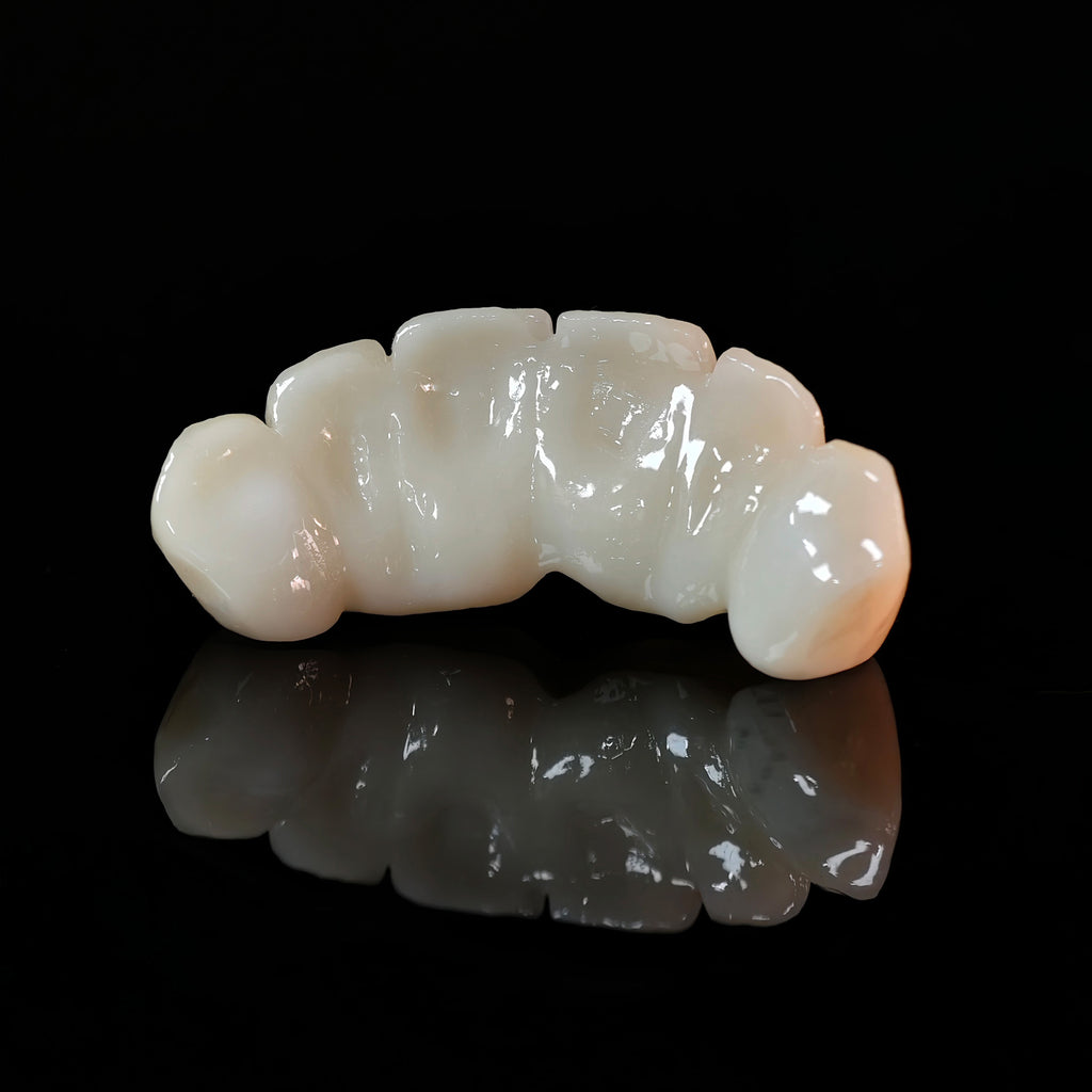 High - Strength Zirconia Bridge