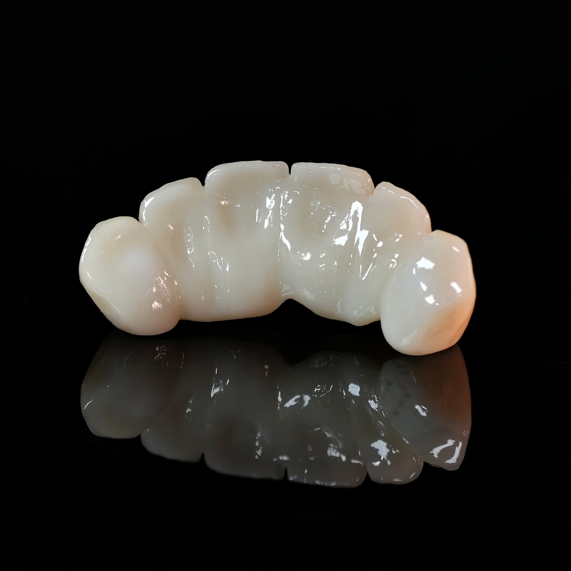 High - Strength Zirconia Bridge