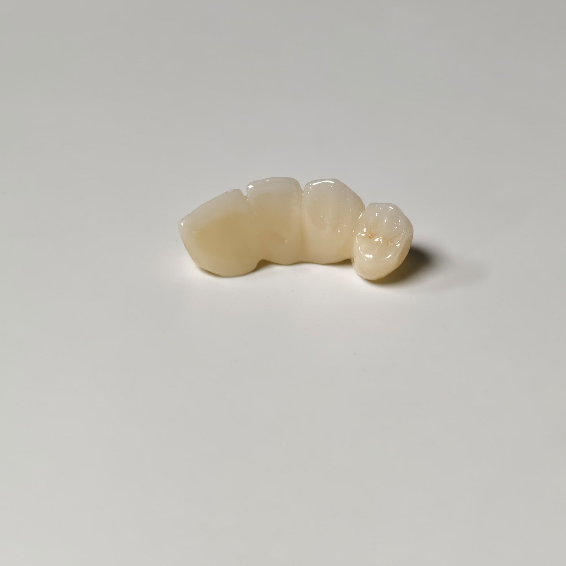 High - Strength Zirconia Bridge