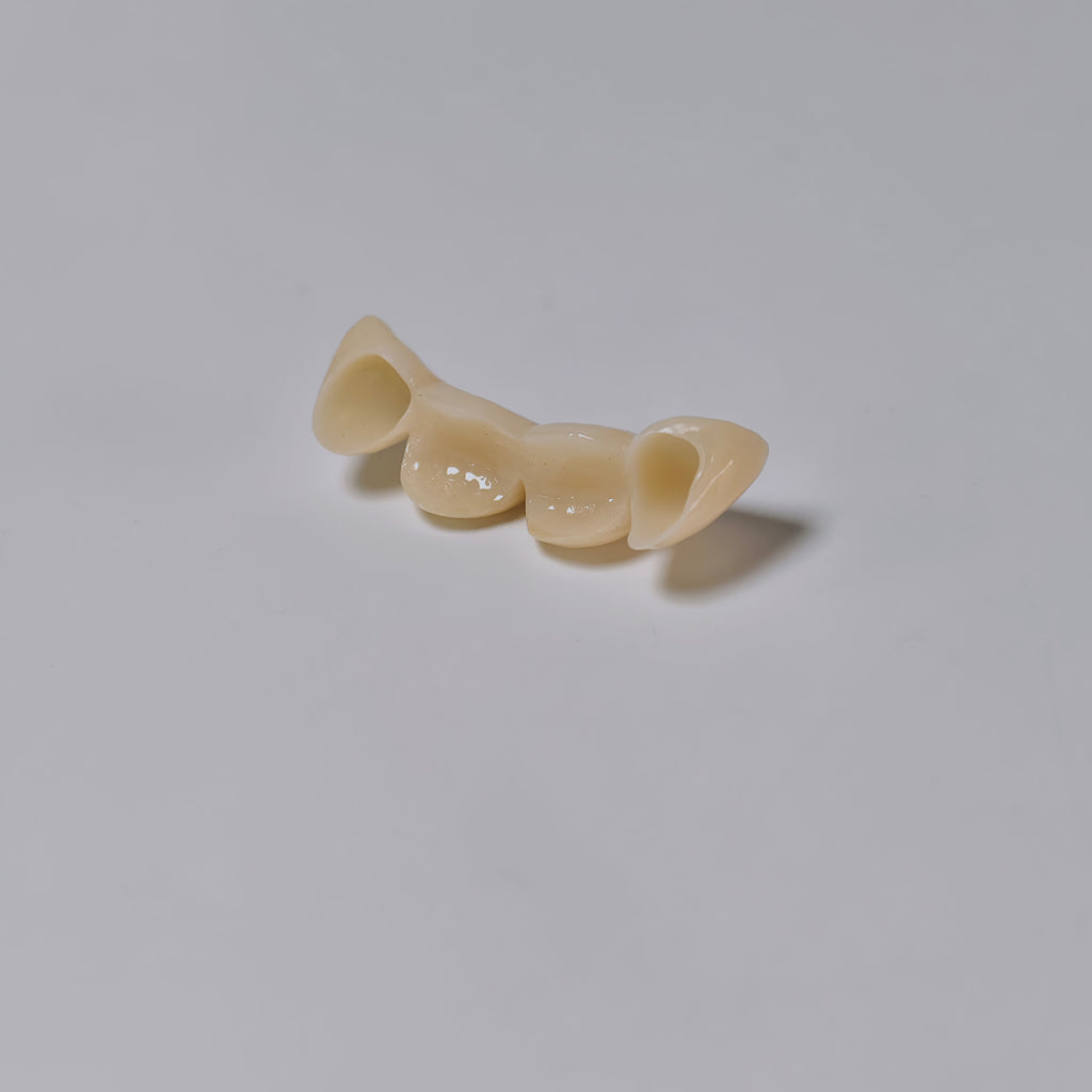 High - Strength Zirconia Bridge