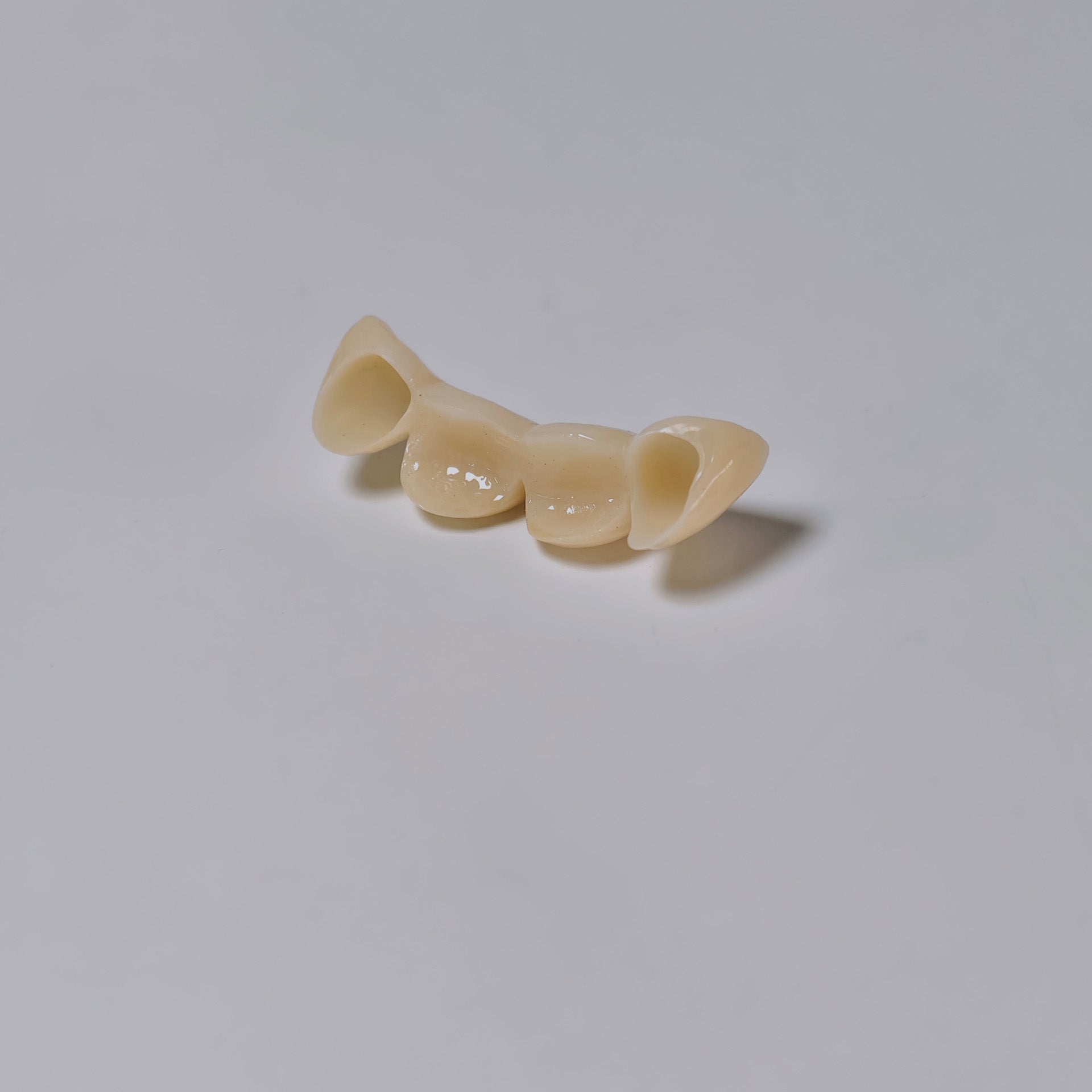High - Strength Zirconia Bridge