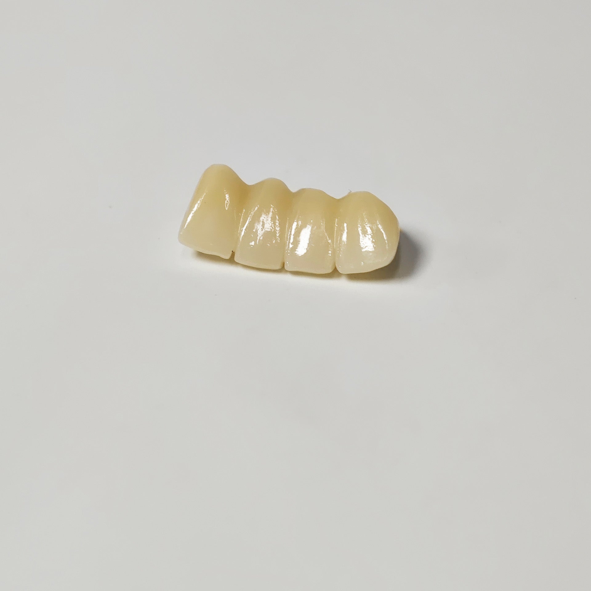 High - Strength Zirconia Bridge