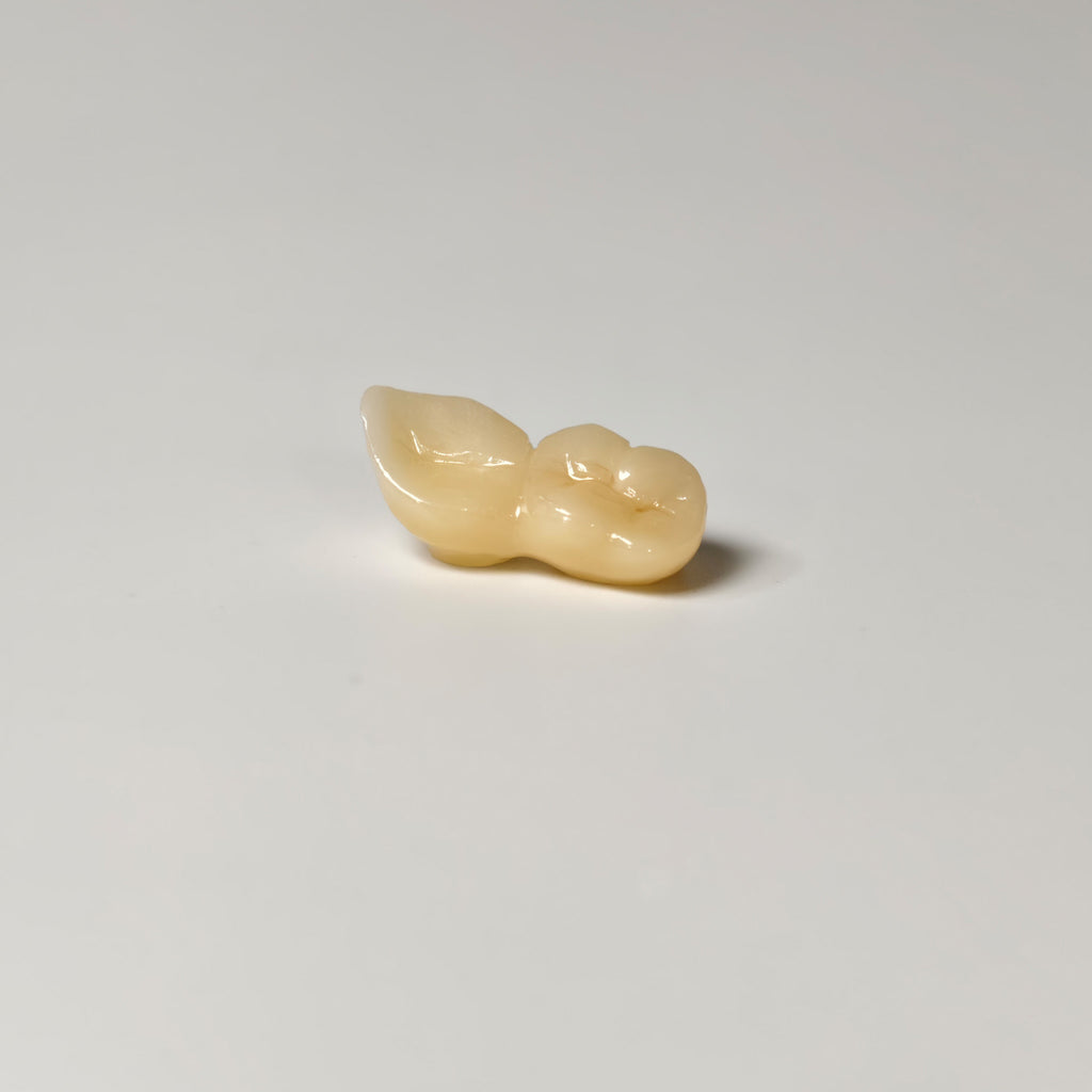 High - Strength Zirconia Bridge