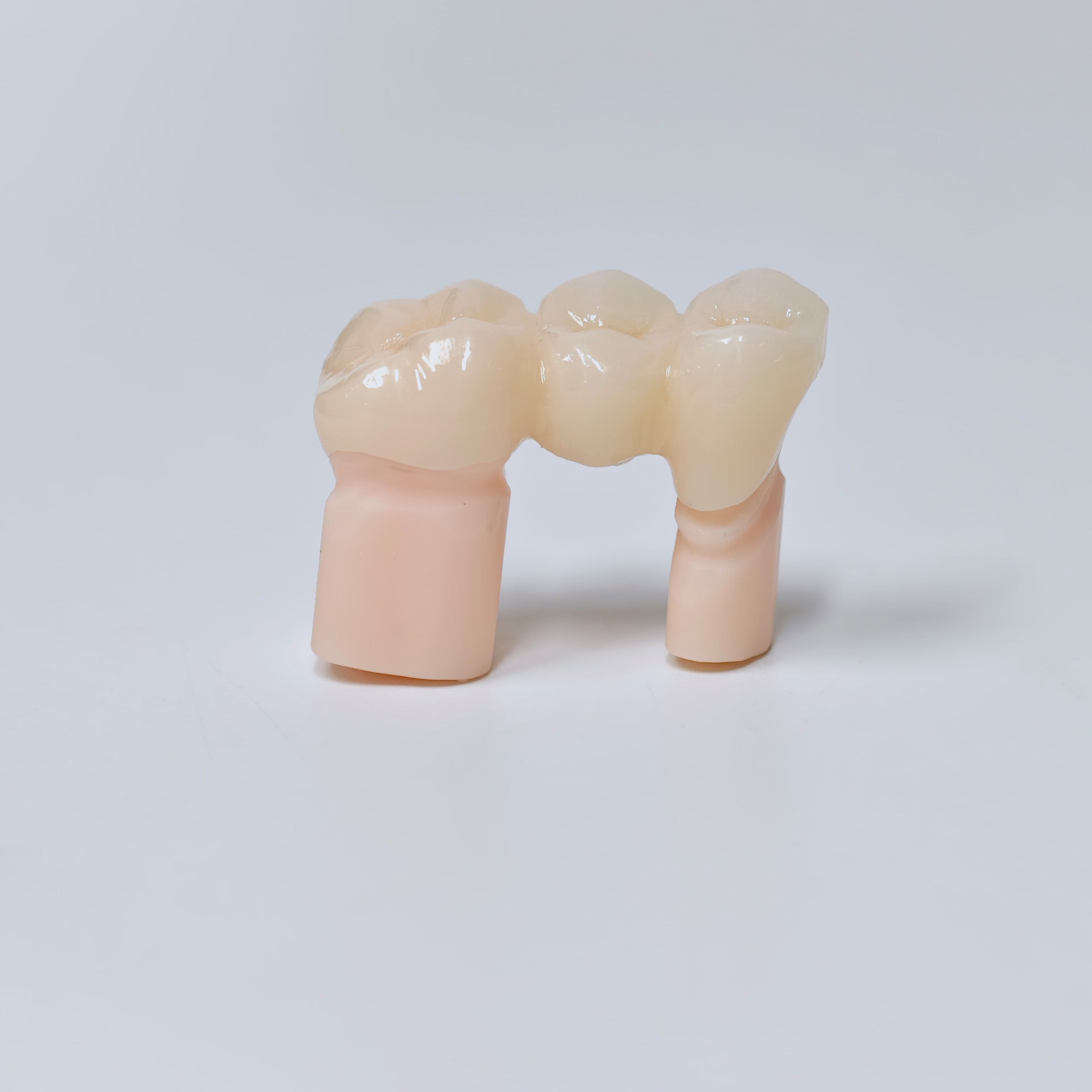 High - Strength Zirconia Bridge