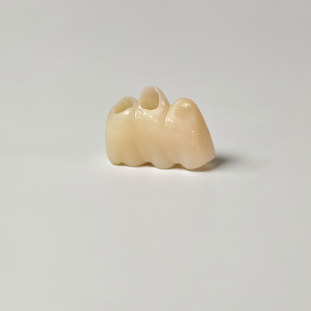High - Strength Zirconia Bridge