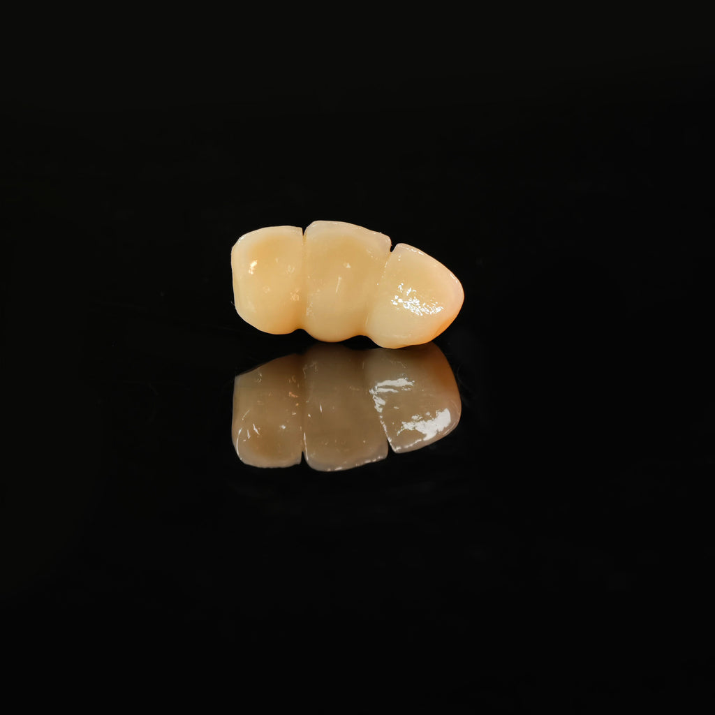 High - Strength Zirconia Bridge