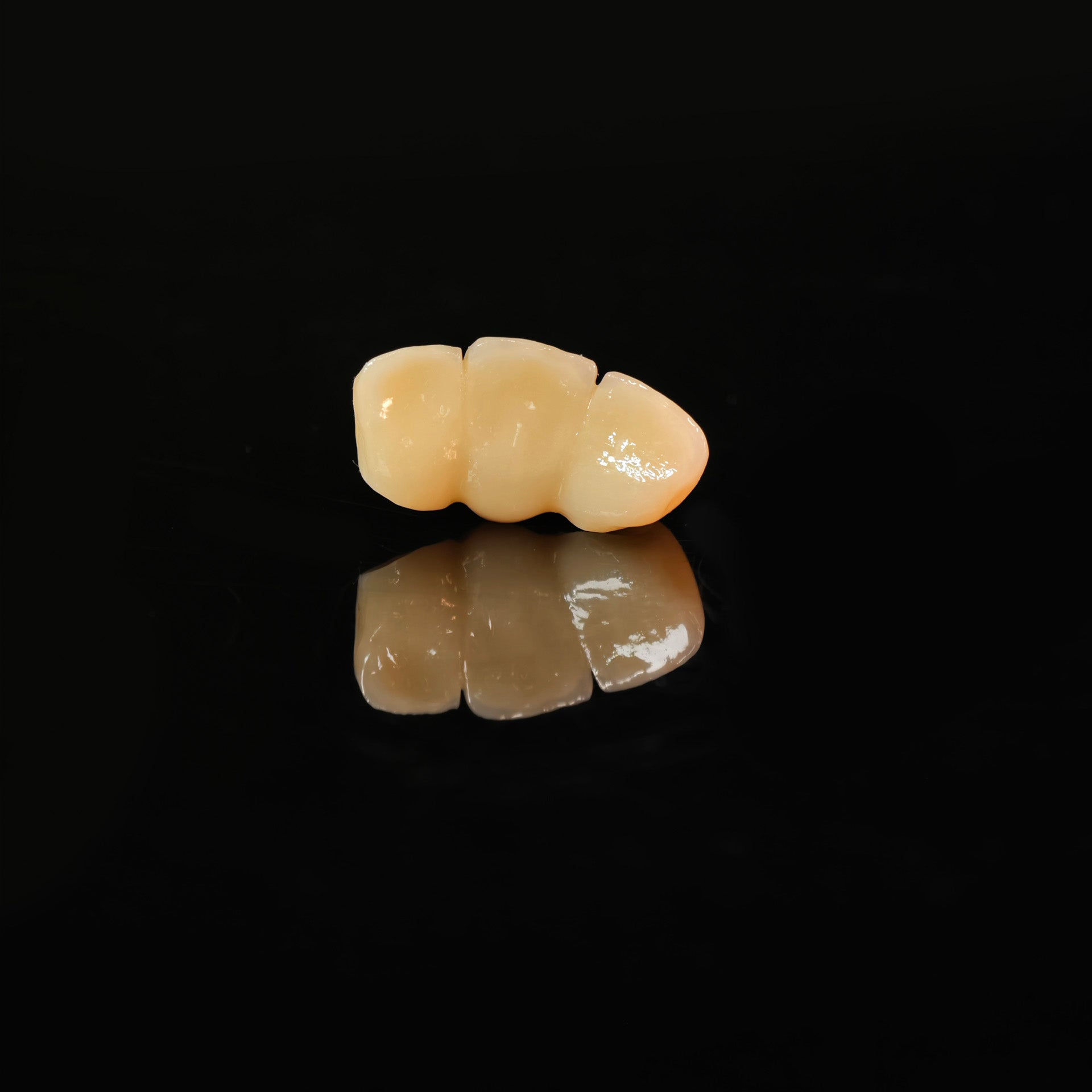 High - Strength Zirconia Bridge