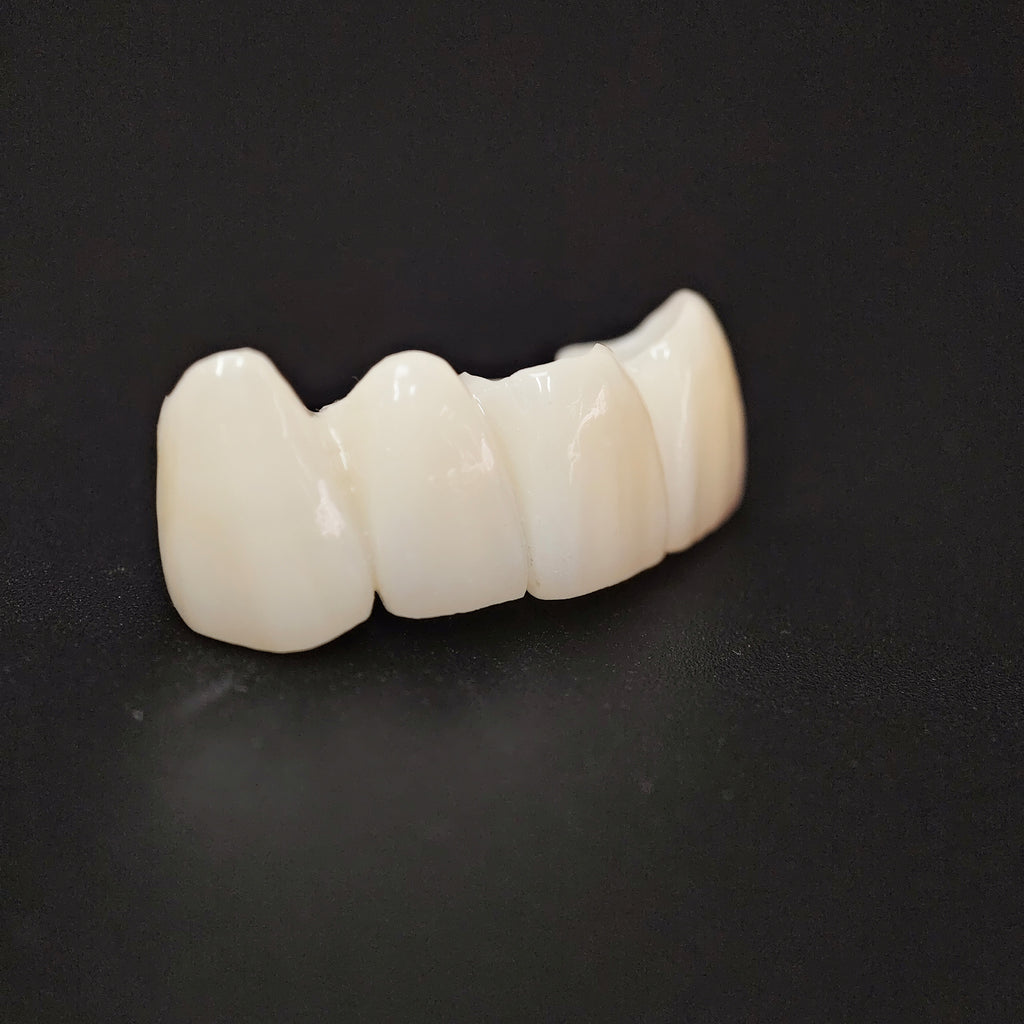 High - Strength Zirconia Bridge