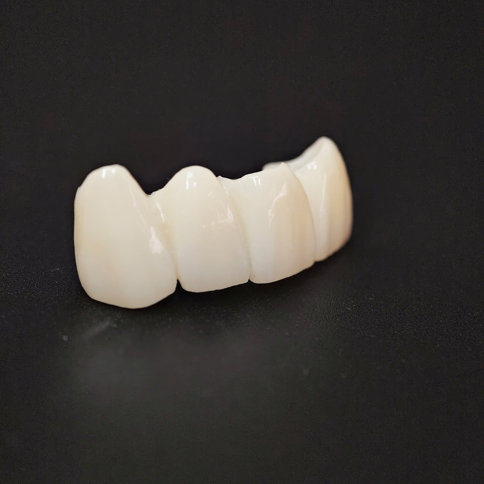 High - Strength Zirconia Bridge