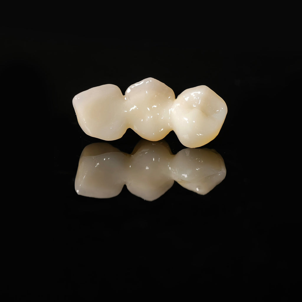 High - Strength Zirconia Bridge