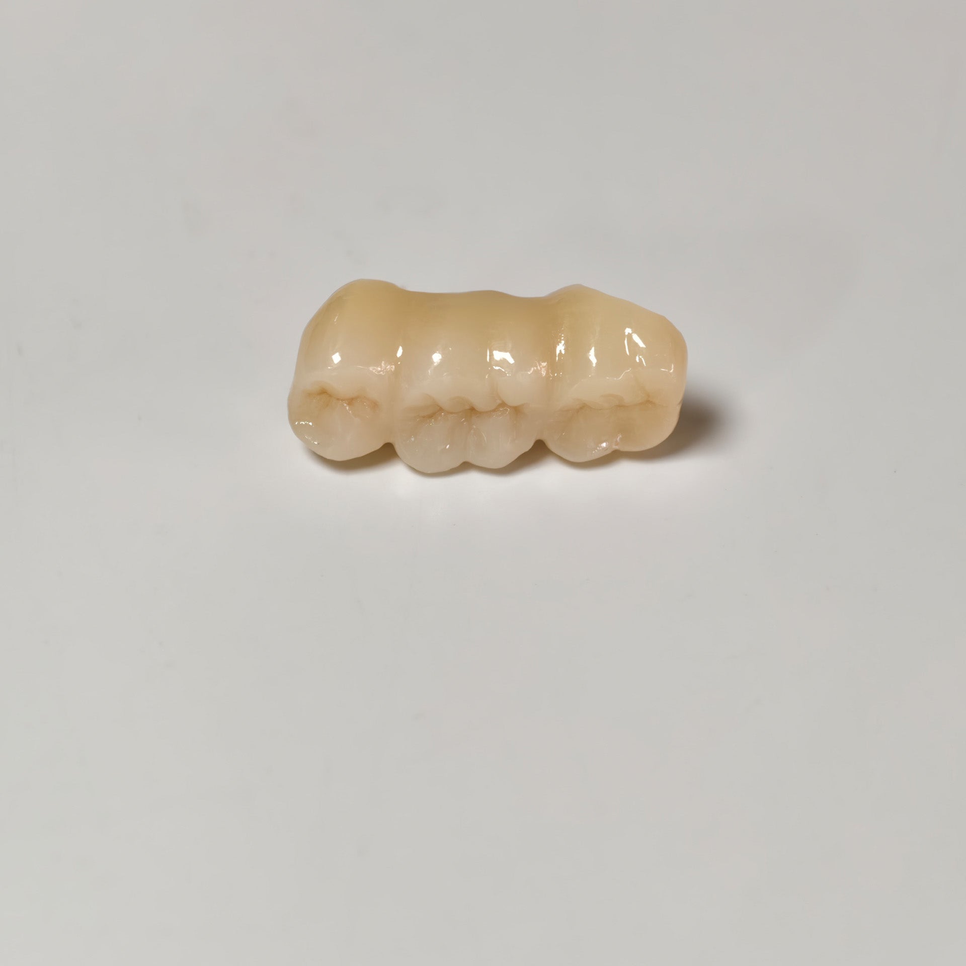 High - Strength Zirconia Bridge