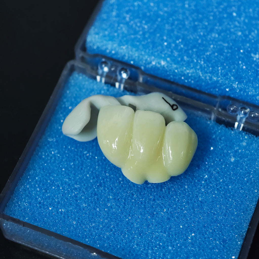 High - Strength Zirconia Bridge