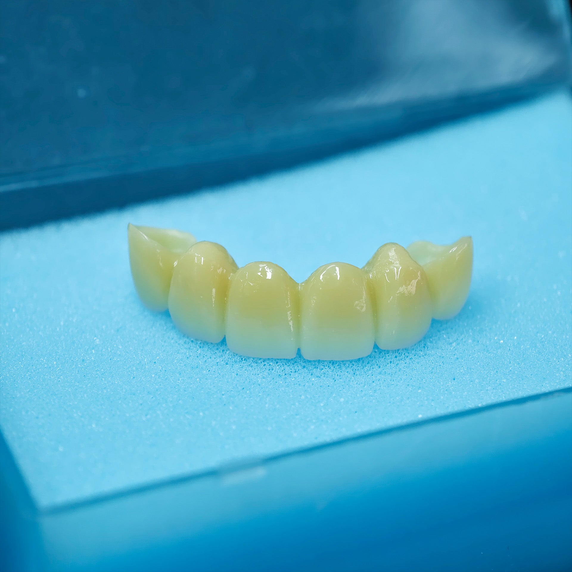 High - Strength Zirconia Bridge
