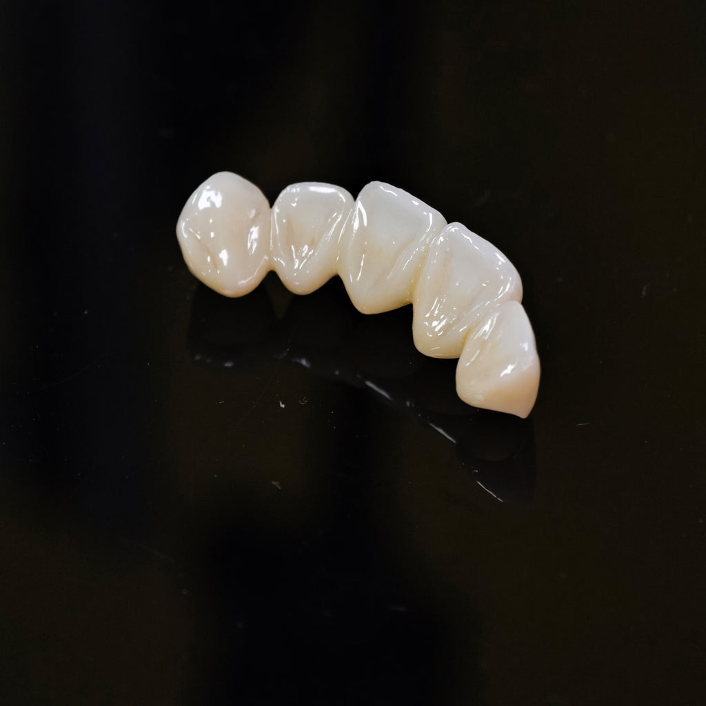 High - Strength Zirconia Bridge
