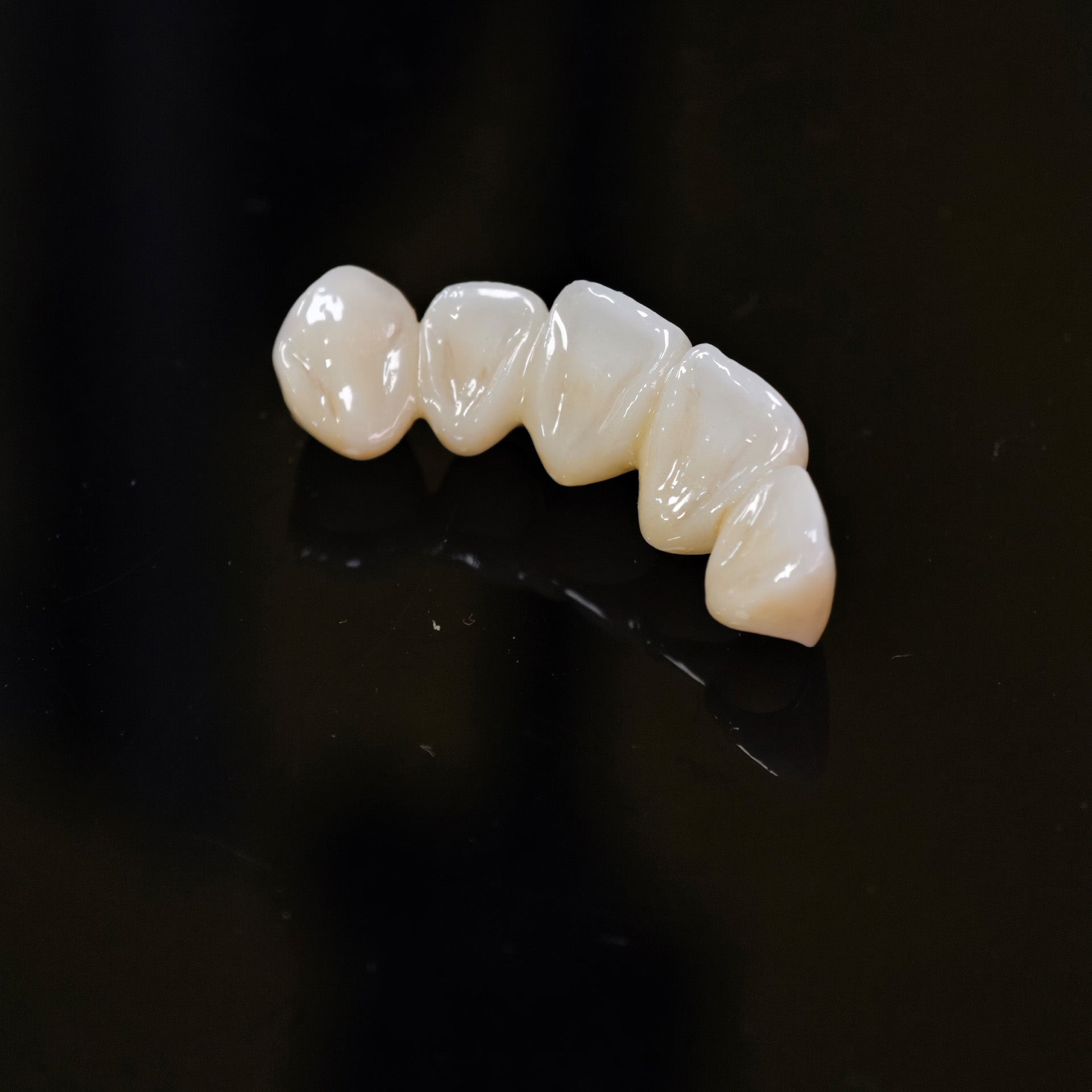 High - Strength Zirconia Bridge