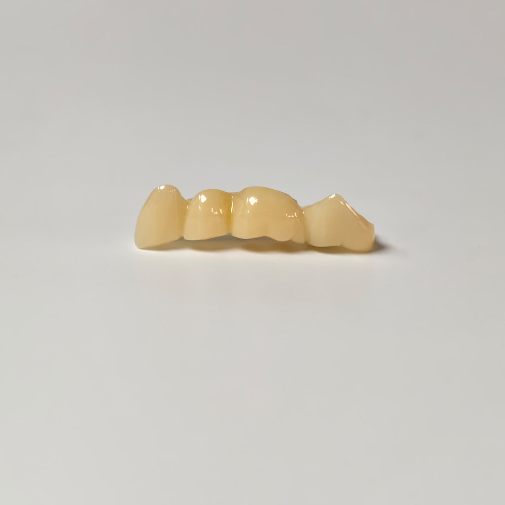 High - Strength Zirconia Bridge