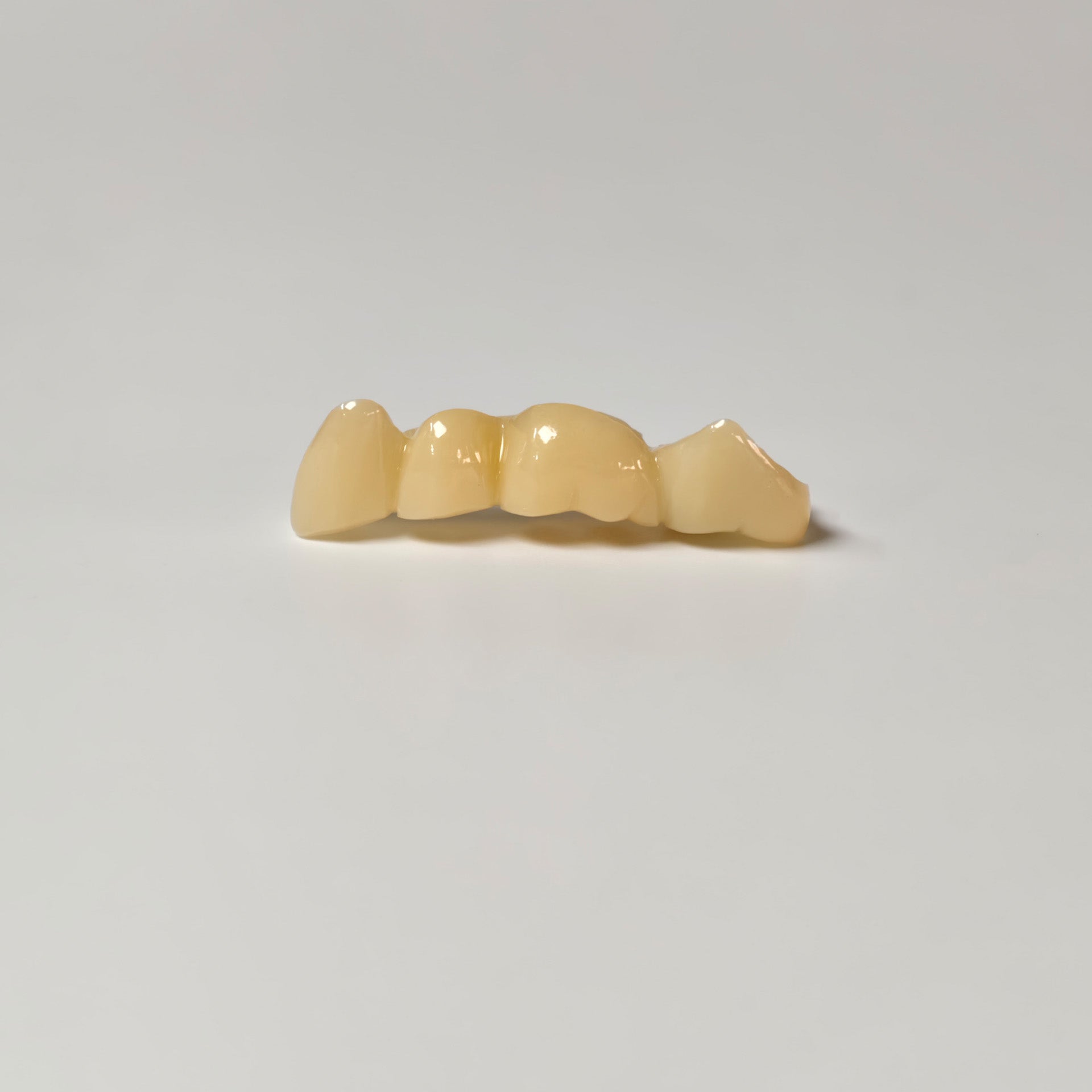 High - Strength Zirconia Bridge