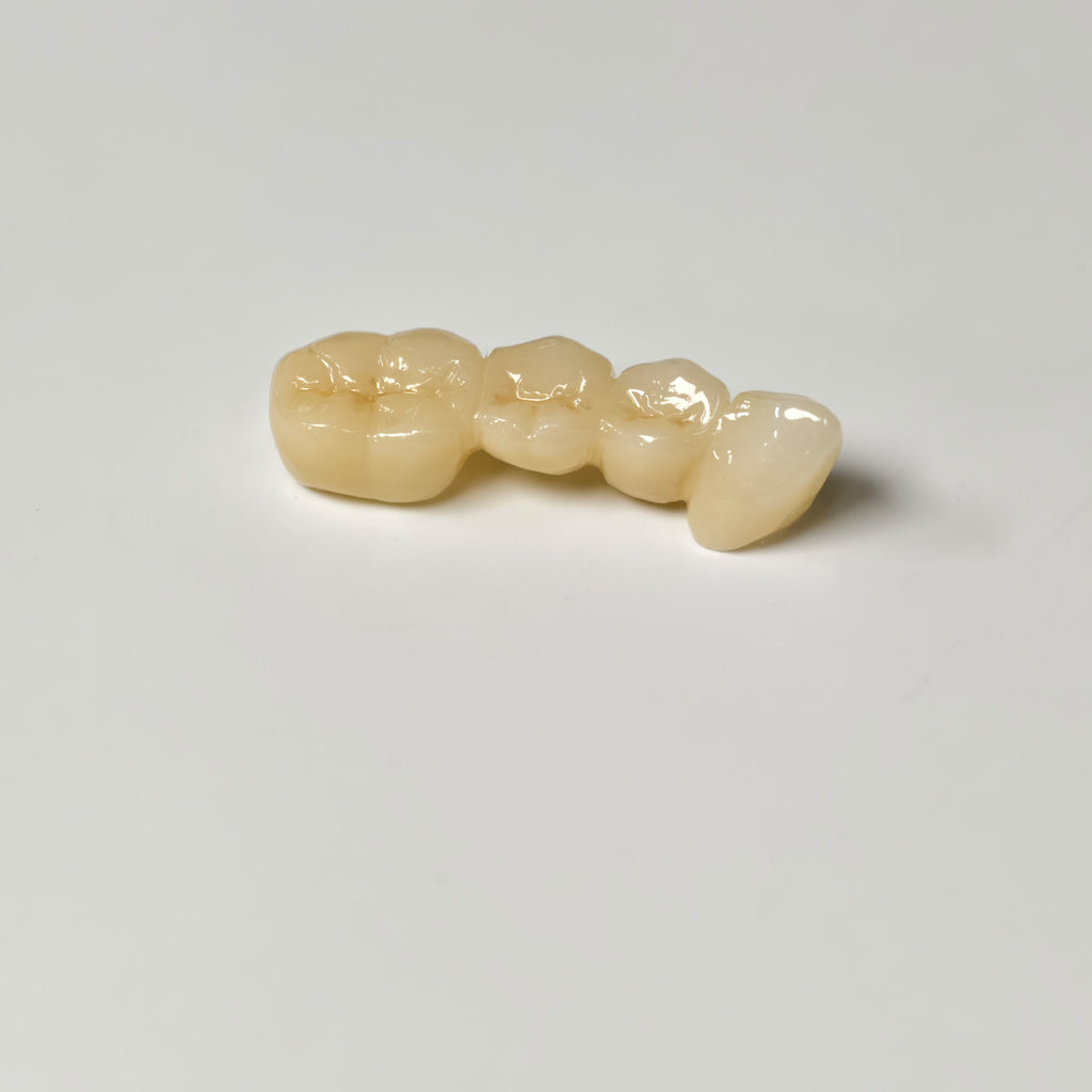 High - Strength Zirconia Bridge