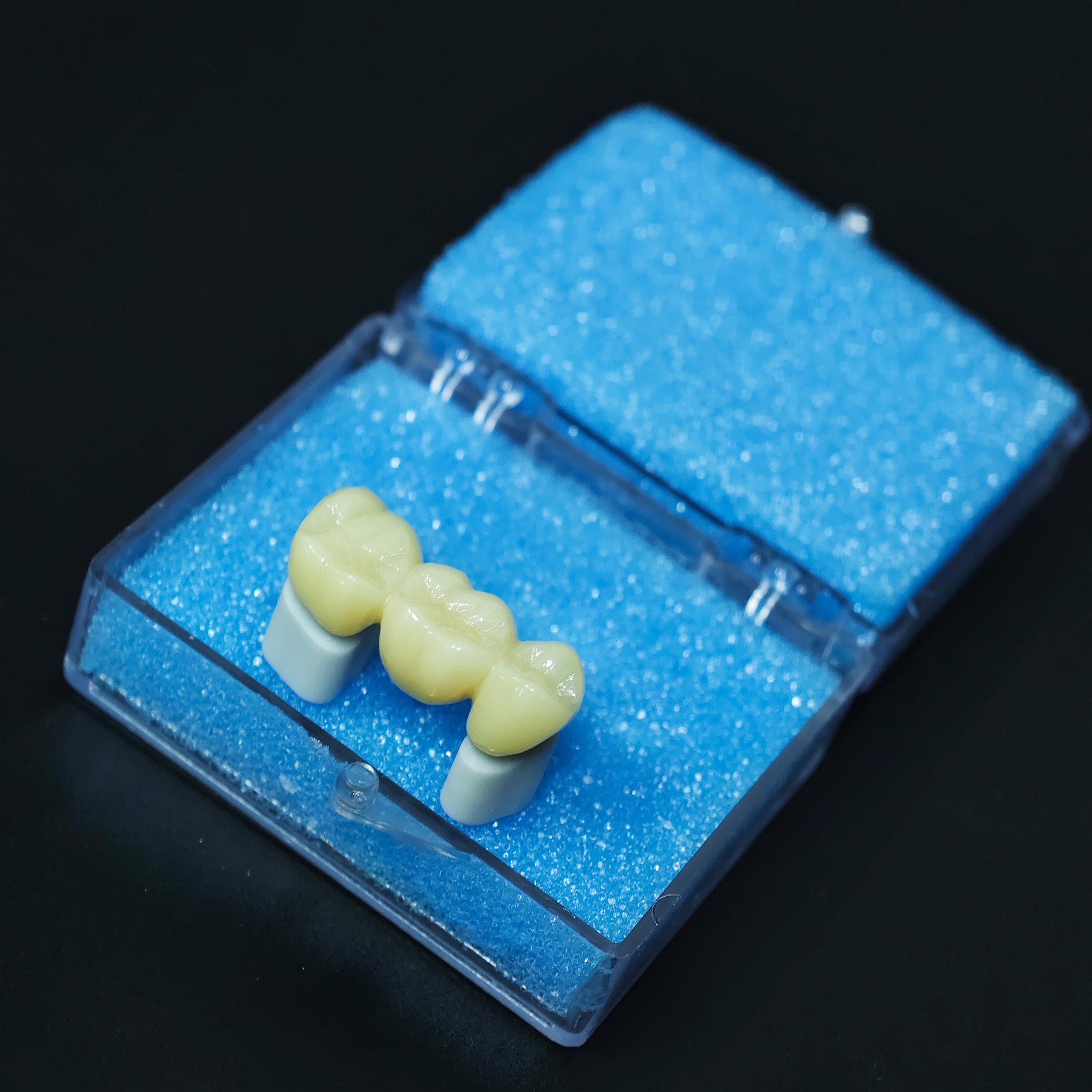 High - Strength Zirconia Bridge