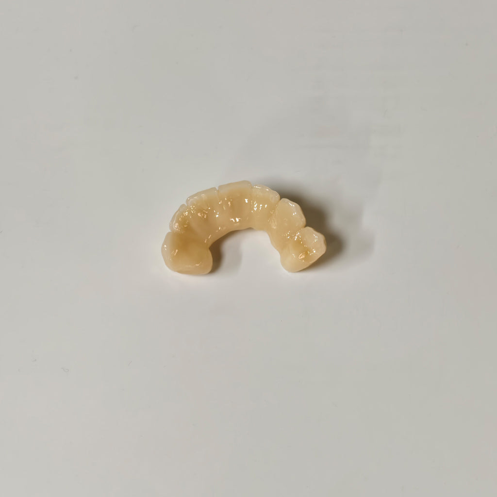 High - Strength Zirconia Bridge