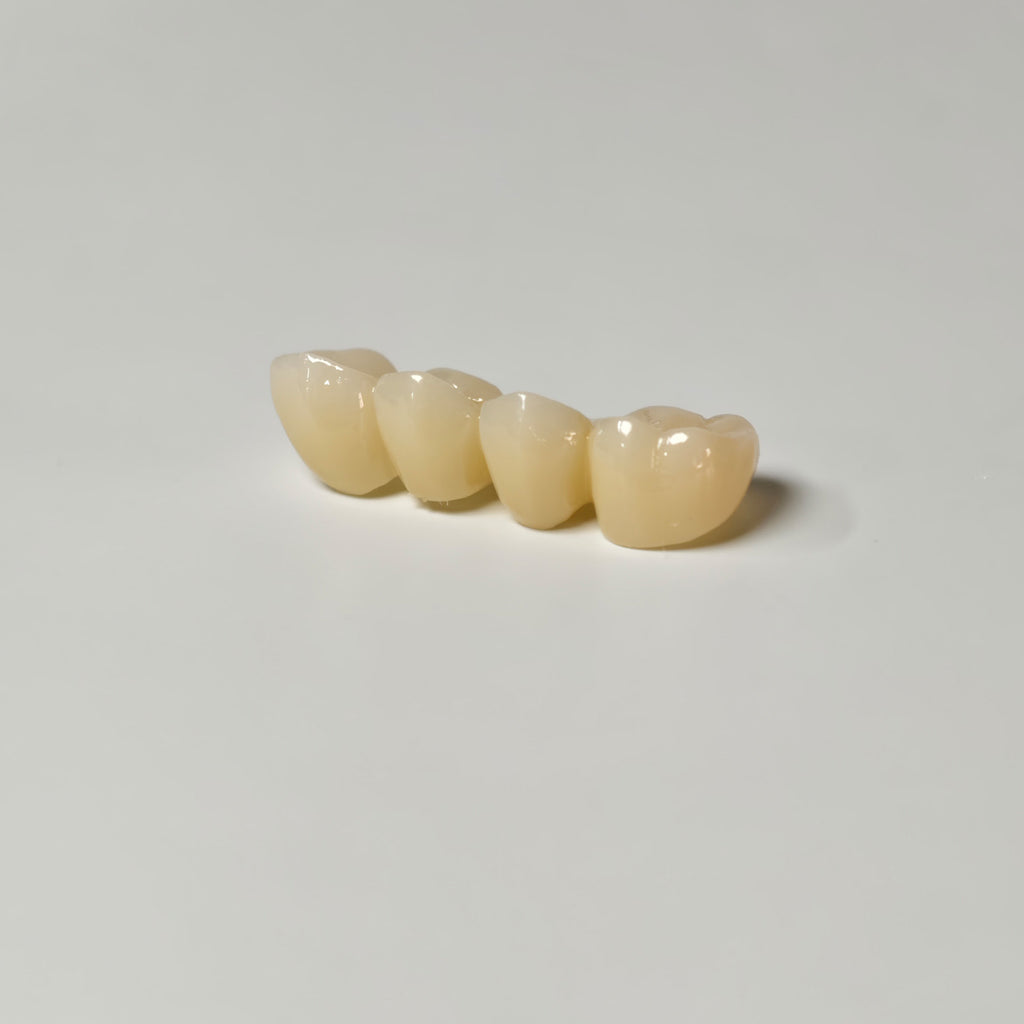 High - Strength Zirconia Bridge