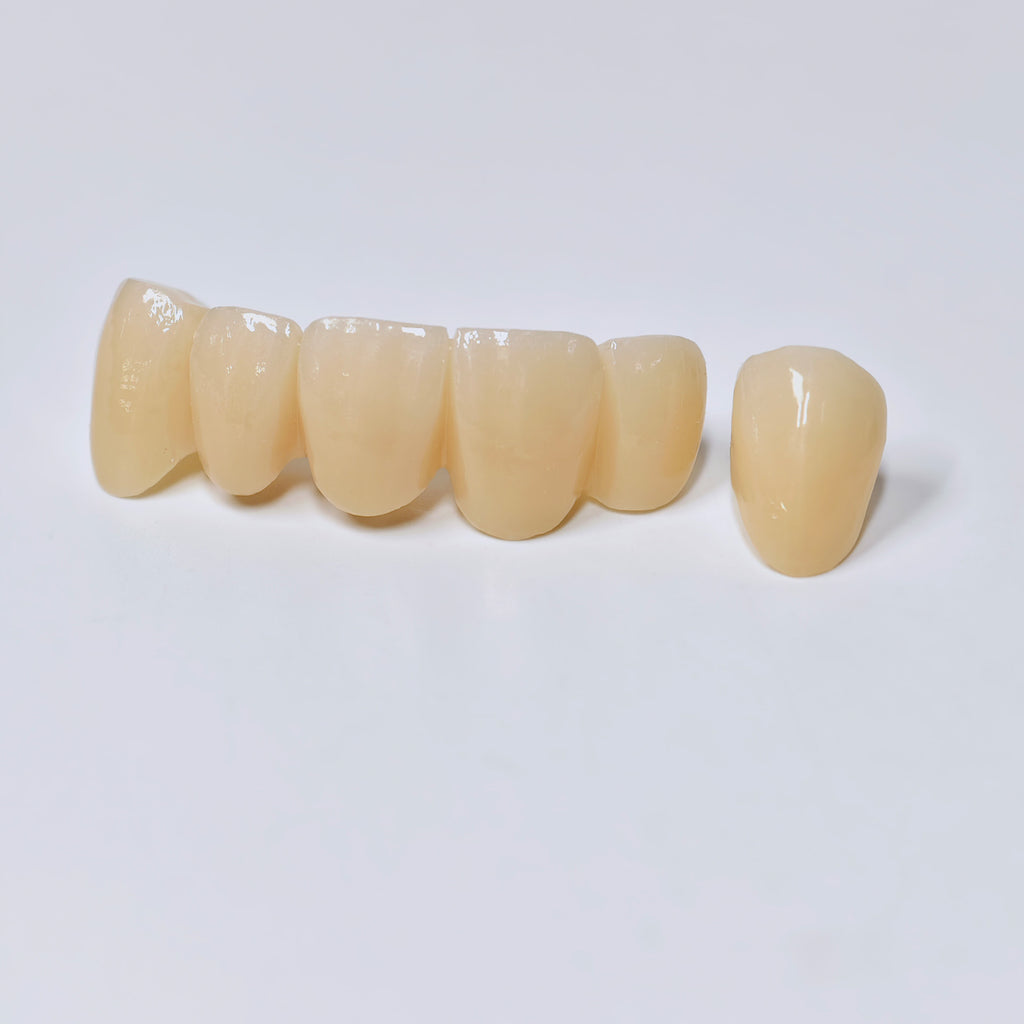 High - Strength Zirconia Crown And Bridge